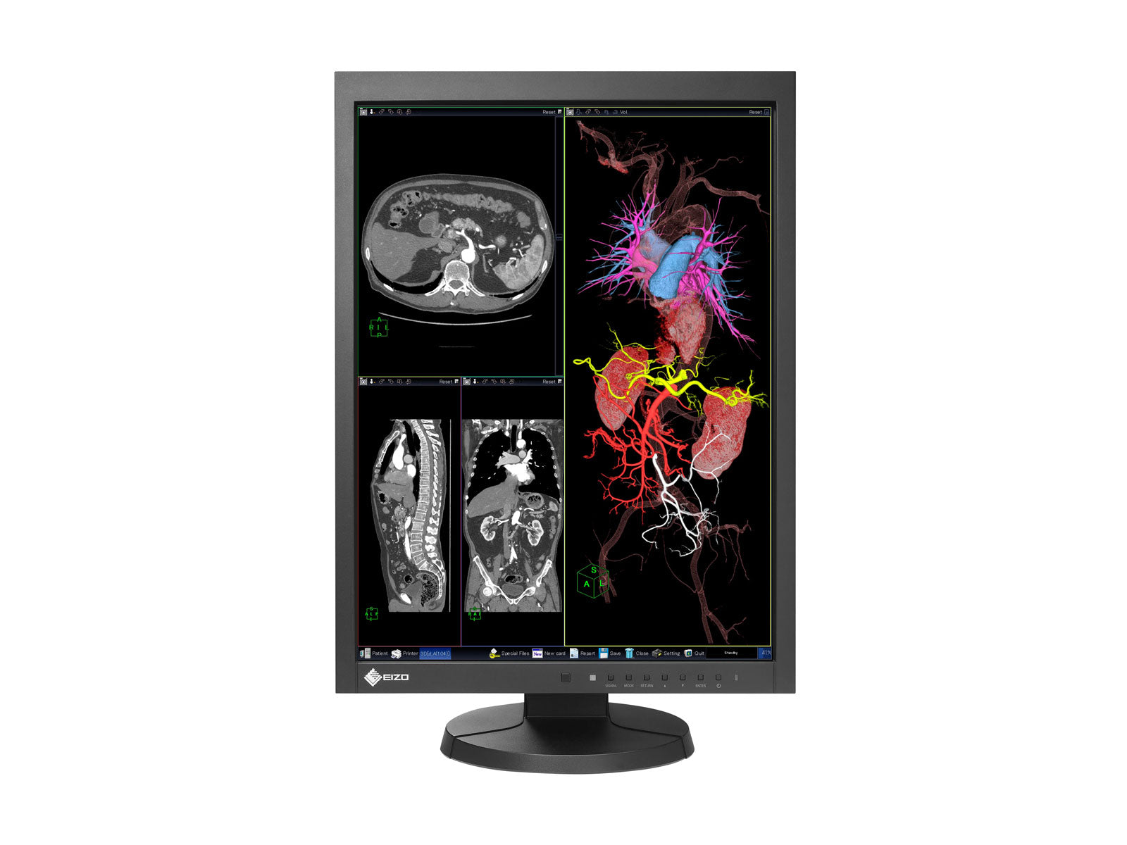 Monitor Médico Eizo MX215-BK 2MP – 21" – Color – Radiología Diagnóstica DICOM (2)