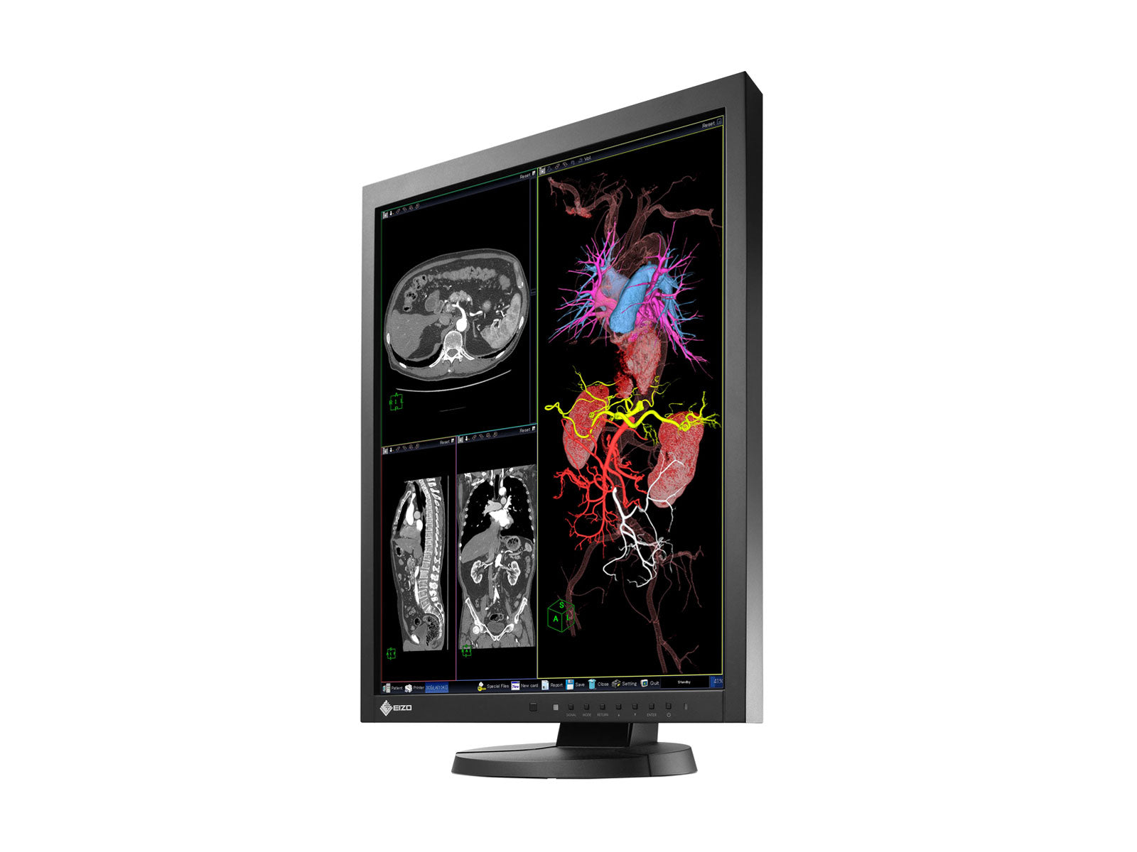 Monitor Médico Eizo MX215-BK 2MP – 21" – Color – Radiología Diagnóstica DICOM (3)
