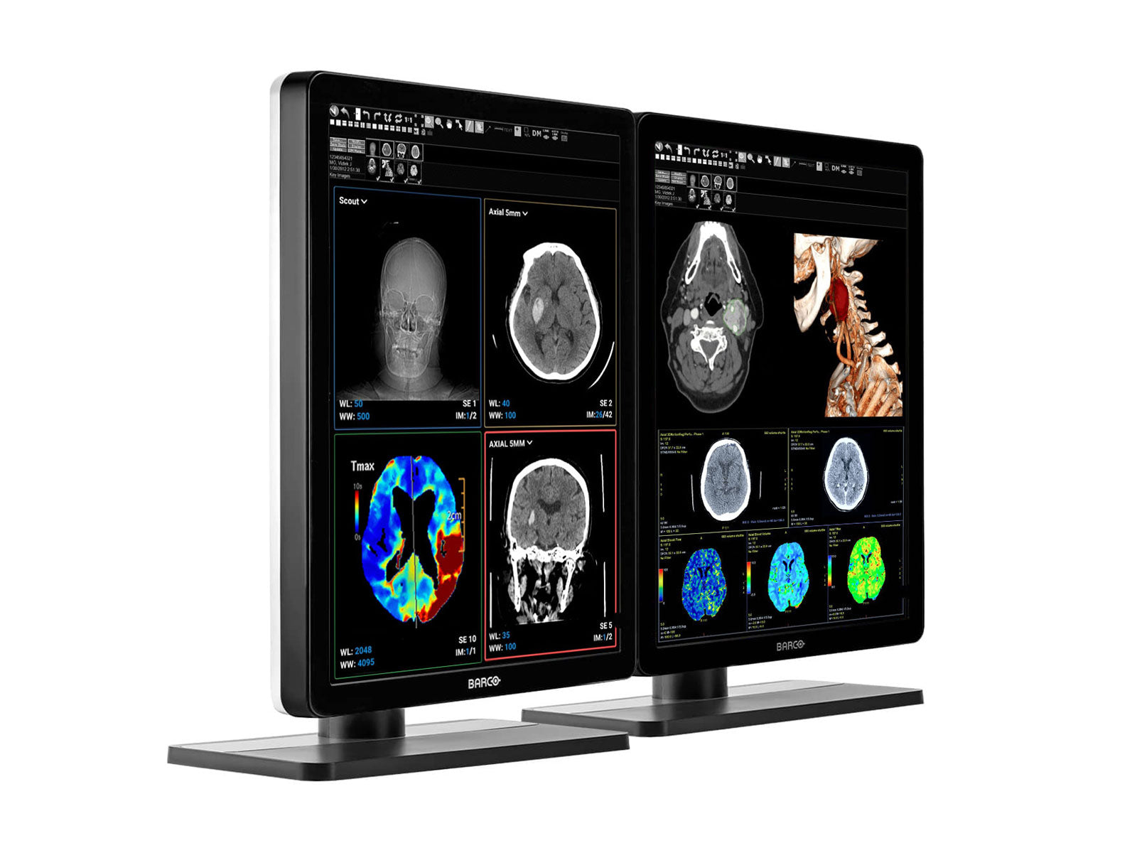 Monitor Médico Barco MDNC-3421 3MP – 21.3" – Color – Radiología Diagnóstica DICOM (2)