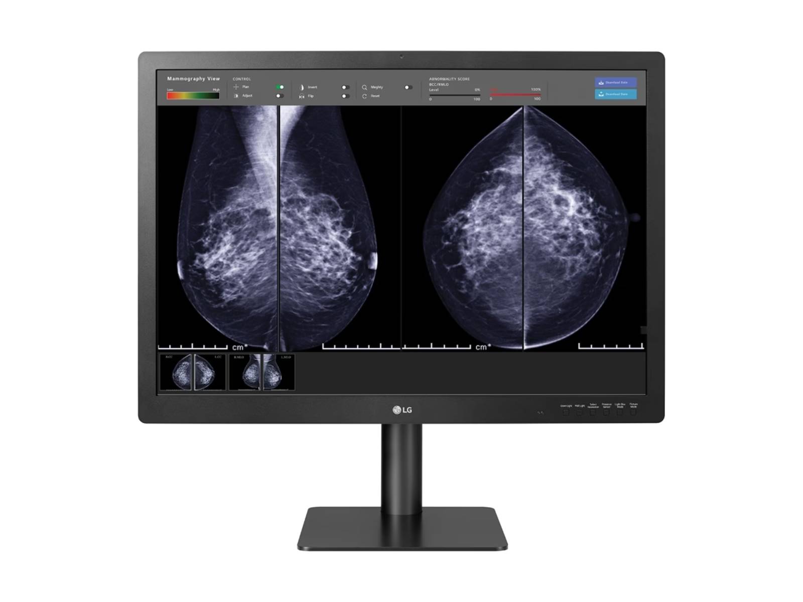 Monitor Médico LG 31HN713D-B 12MP – 31.5" – Color – Radiología Diagnóstica DICOM (2)