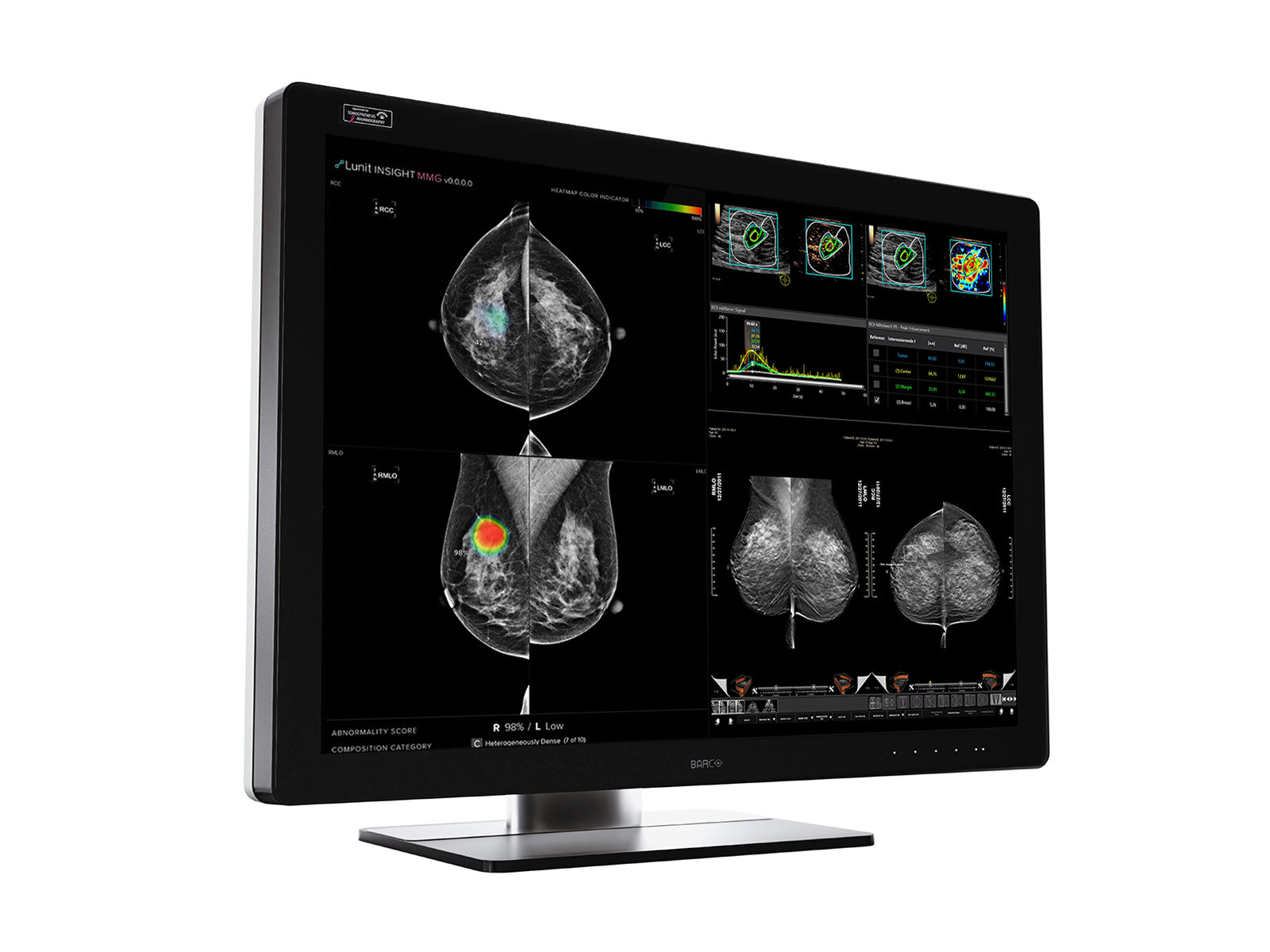 Monitor Médico Barco MDMC-12133 12MP – 33.6" – Color – Radiología Diagnóstica DICOM (3)