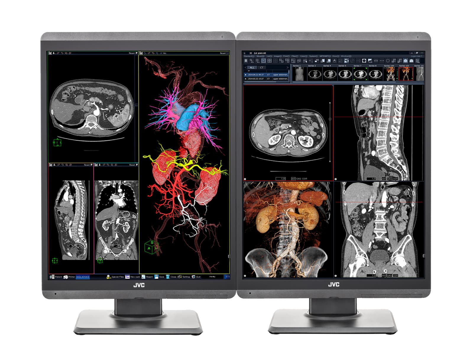 Monitor Médico JVC CL-S300 3MP – 21.3" – Color – Radiología Diagnóstica DICOM (1)