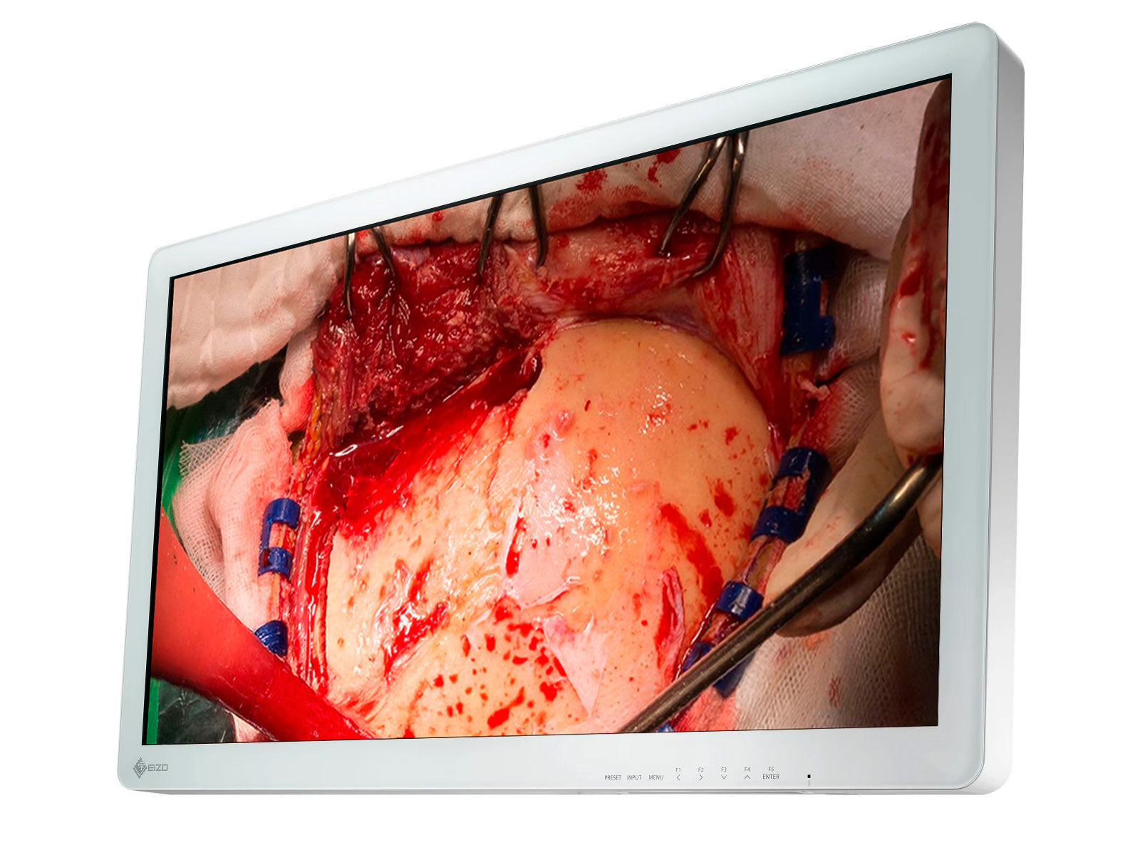 Monitor Médico Eizo EX3220 31.5" – Uso Quirúrgico DICOM (3)