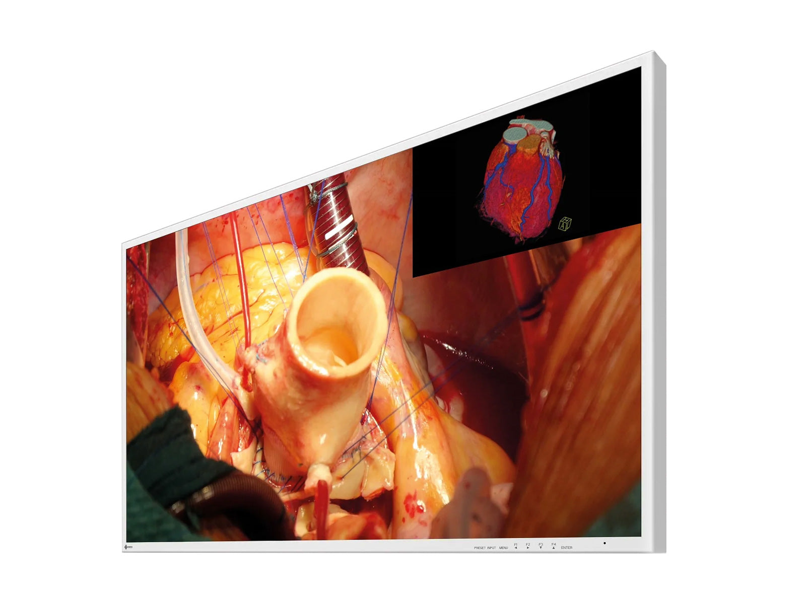 Monitor Médico Eizo EX4342 43" – Uso Quirúrgico DICOM (2)