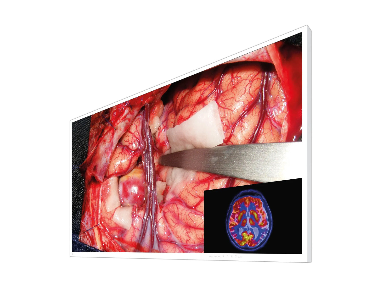 Monitor Médico Eizo EX5542 55" – Uso Quirúrgico DICOM (2)