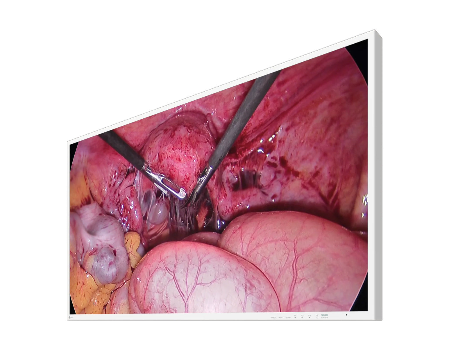 Monitor Médico Eizo EX4342-3D 43" – Uso Quirúrgico DICOM (2)