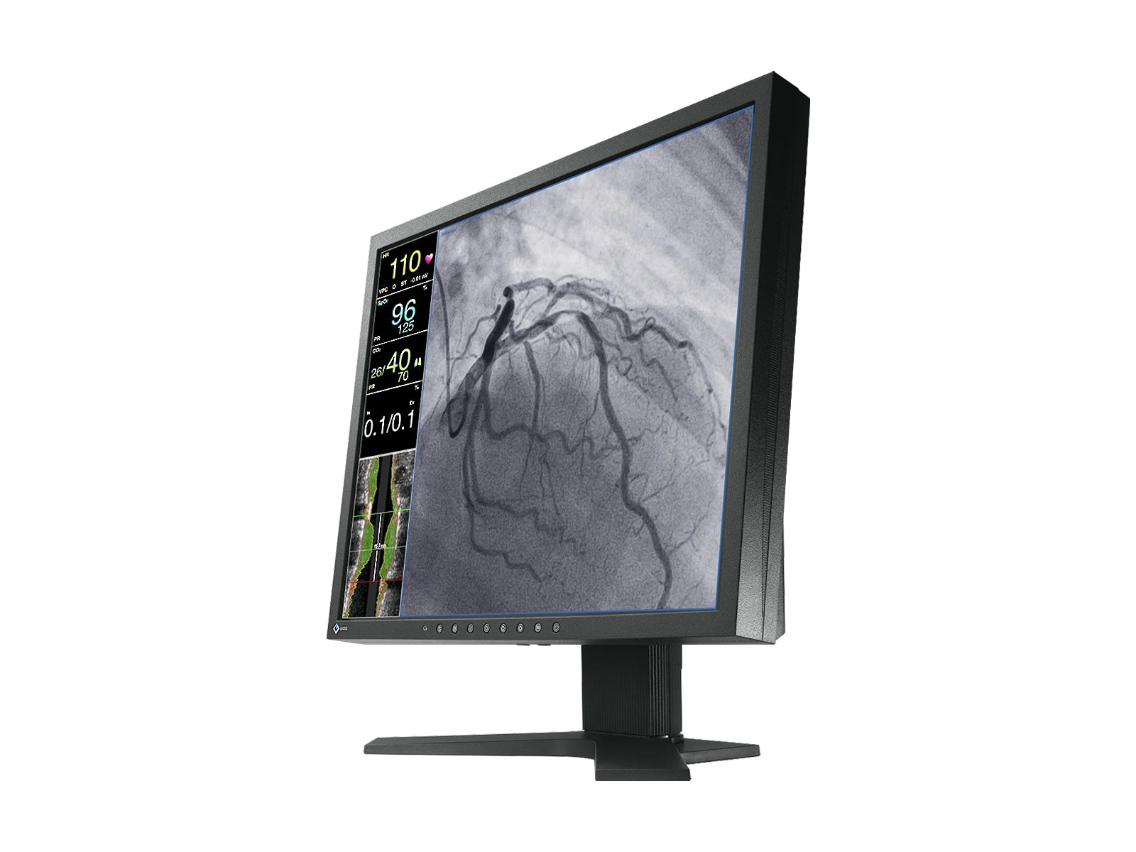 Monitor Médico Eizo LX1910-S 19" – Uso Quirúrgico DICOM (3)