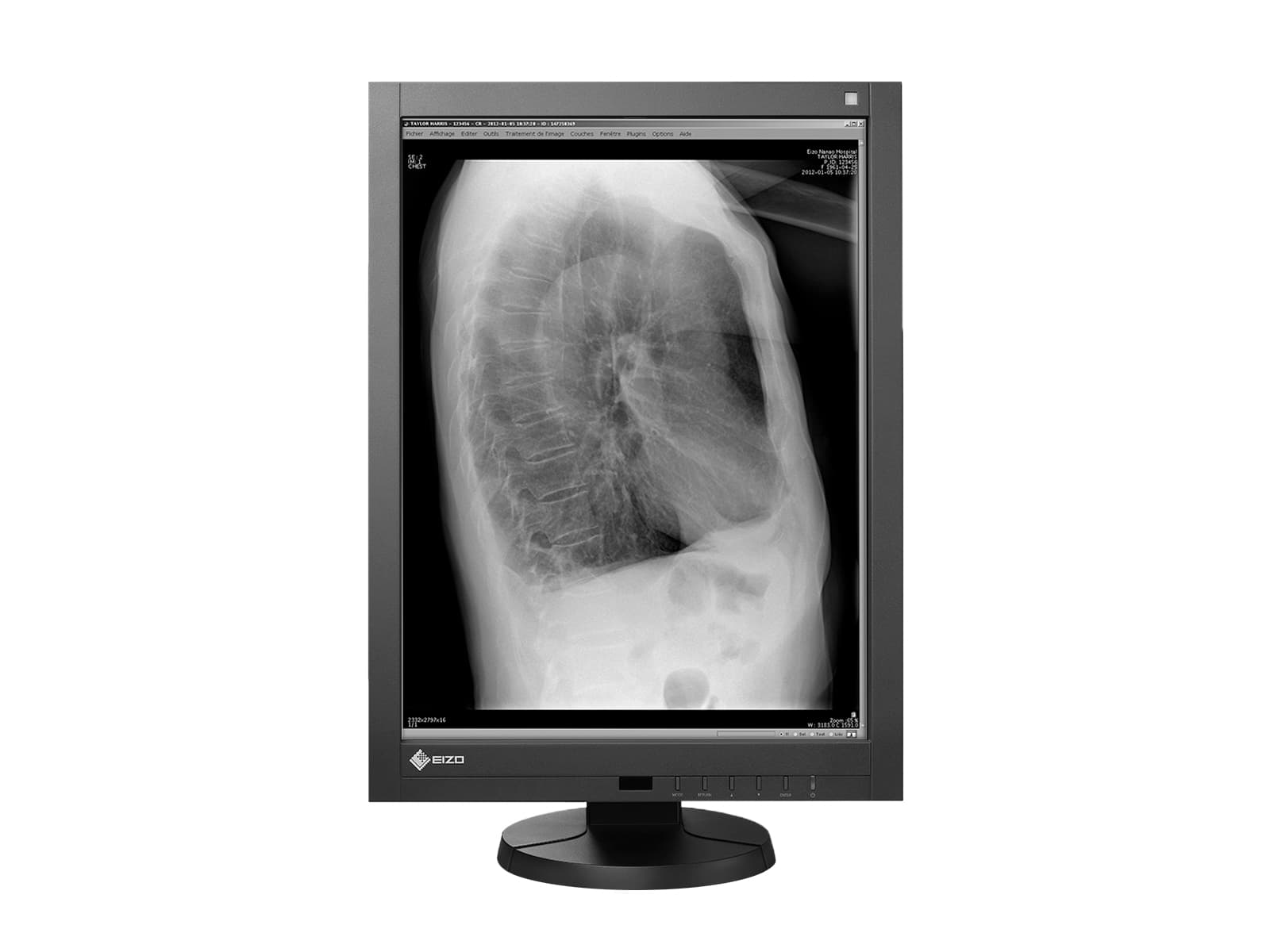 Monitor Médico Eizo GX240 2MP – 21" – Escala de grises – Radiología Diagnóstica DICOM (3)