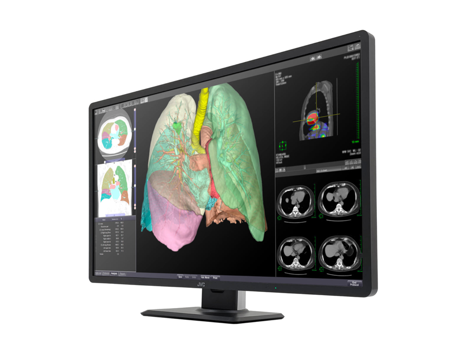 Monitor Médico JVC CL-R813 8MP – 32" – Color – Radiología Diagnóstica (2)
