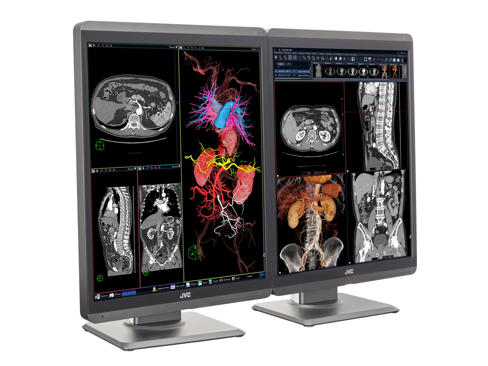 Monitor Médico JVC CL-S200 2MP – 21.3" – Color – Radiología Diagnóstica DICOM (2)