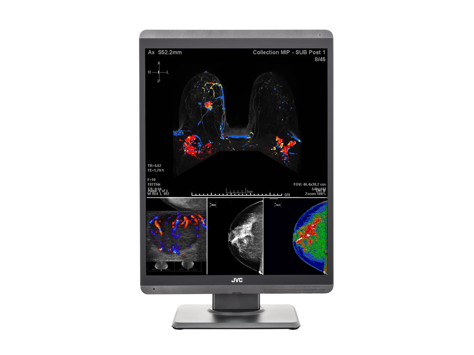 Monitor Médico JVC CL-S500 5MP – 21.3" – Color – Radiología Diagnóstica DICOM (5)