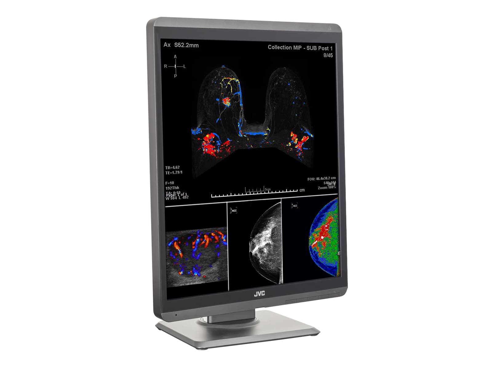 Monitor Médico JVC CL-S500 5MP – 21.3" – Color – Radiología Diagnóstica DICOM (6)