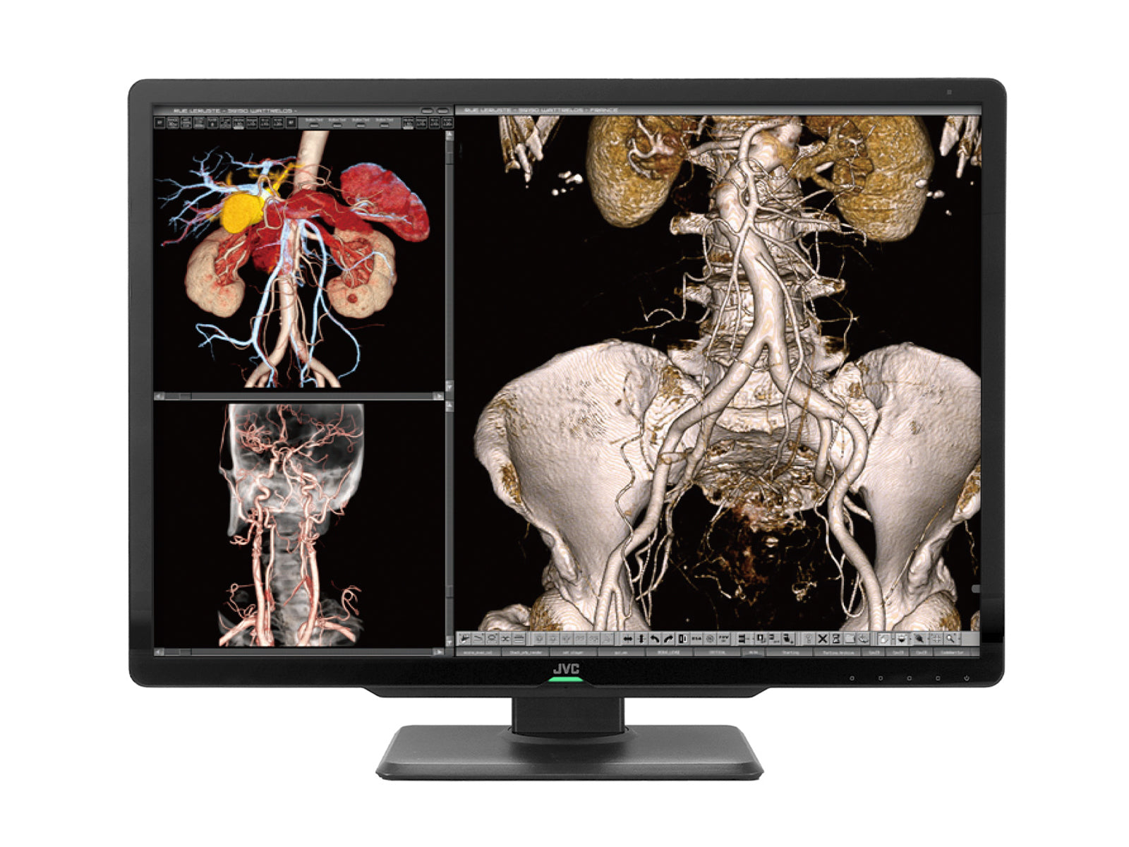 Monitor Médico JVC CL-S600 6MP – 30" – Color – Radiología Diagnóstica DICOM (1)