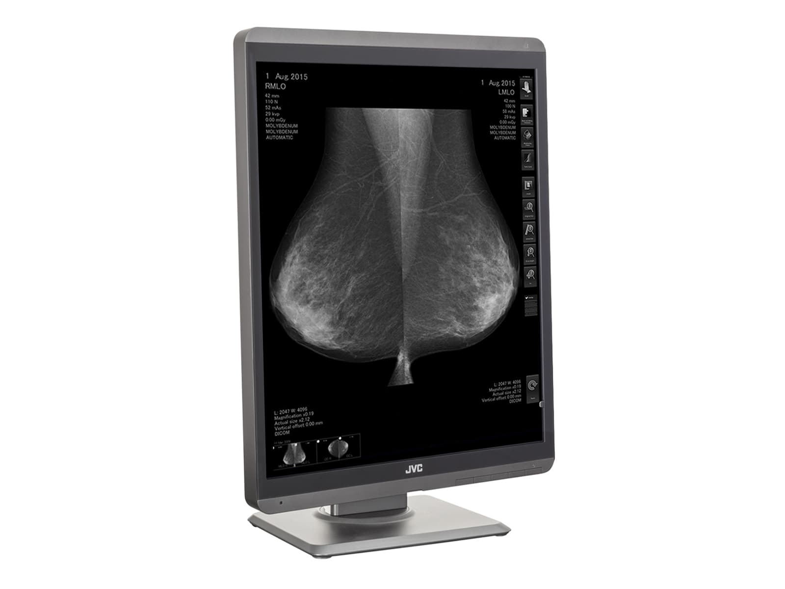 Monitor Médico JVC MS-S500 5MP – 21.3" – Escala de grises – Radiología Diagnóstica (5)