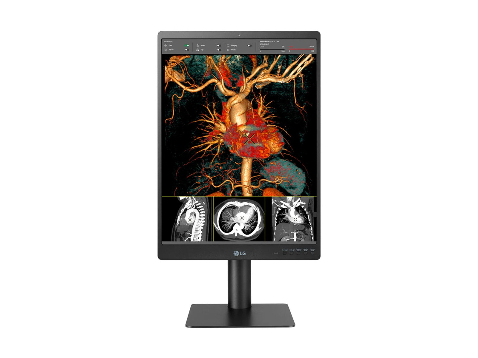 Monitor Médico LG 21HQ513D 3MP – 21" – Color – Radiología Diagnóstica (2)