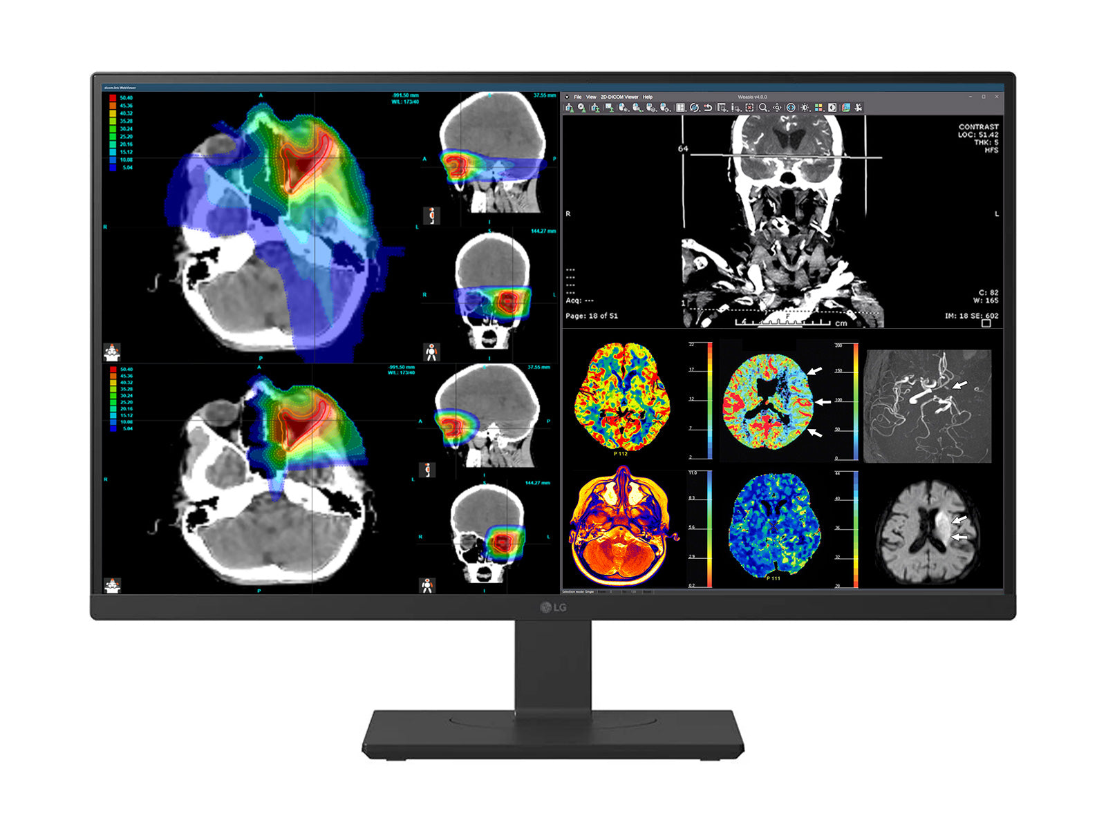 Monitor Médico LG 27HS713C 8MP – 27" – Color – Radiología Diagnóstica DICOM (1)