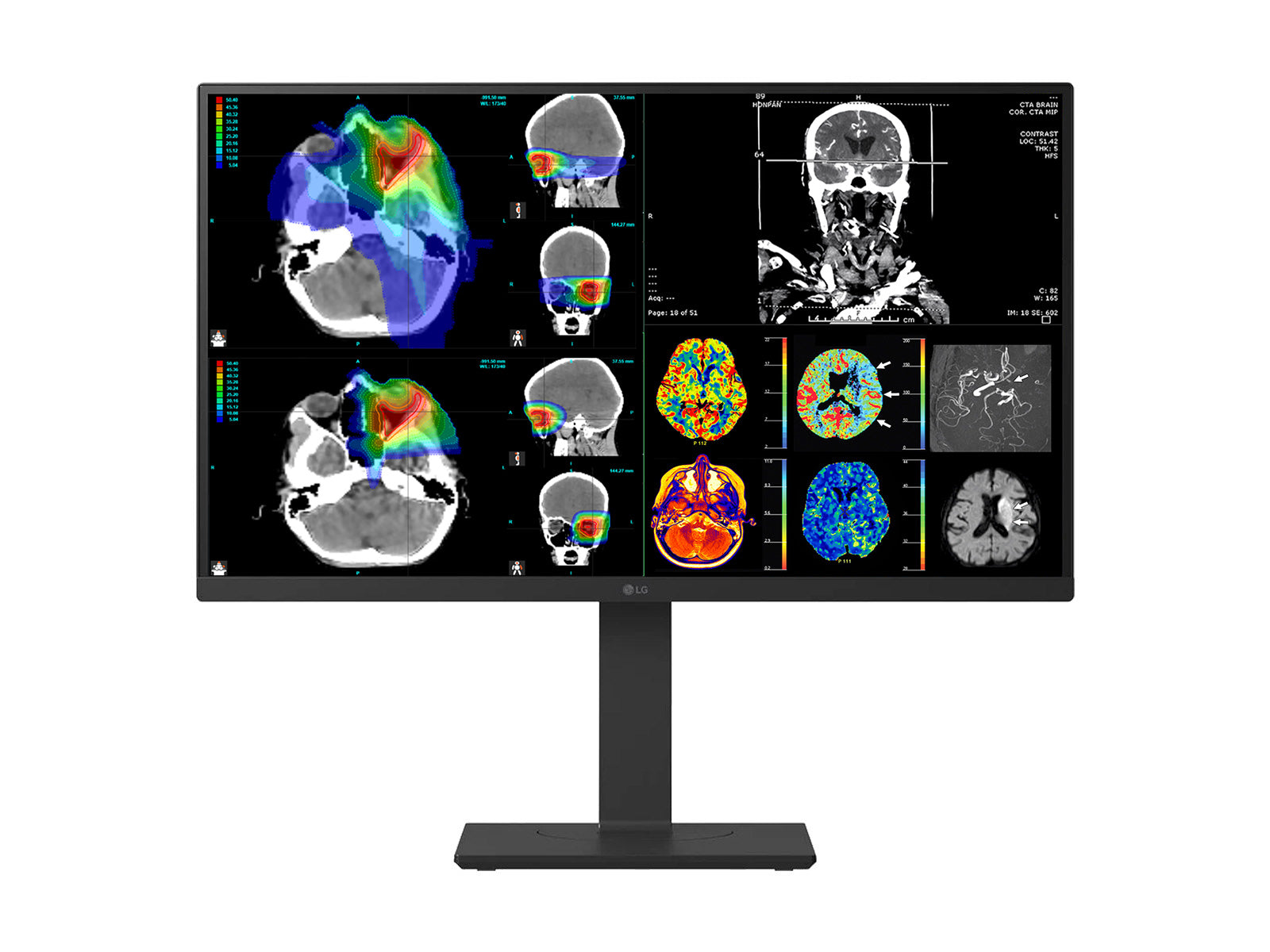 Monitor Médico LG 27HS713C 8MP – 27" – Color – Radiología Diagnóstica DICOM (2)