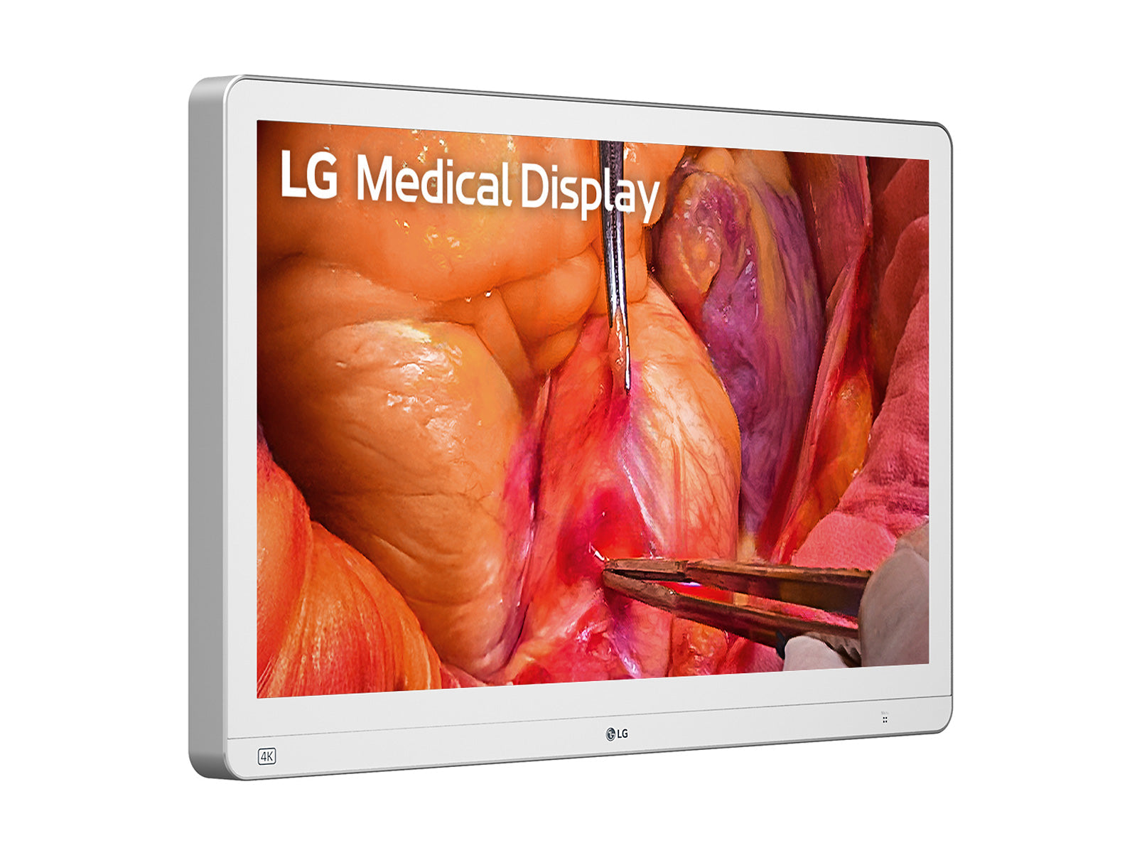 Monitor Médico LG 27HS714S-W 27" – Uso Quirúrgico (3)