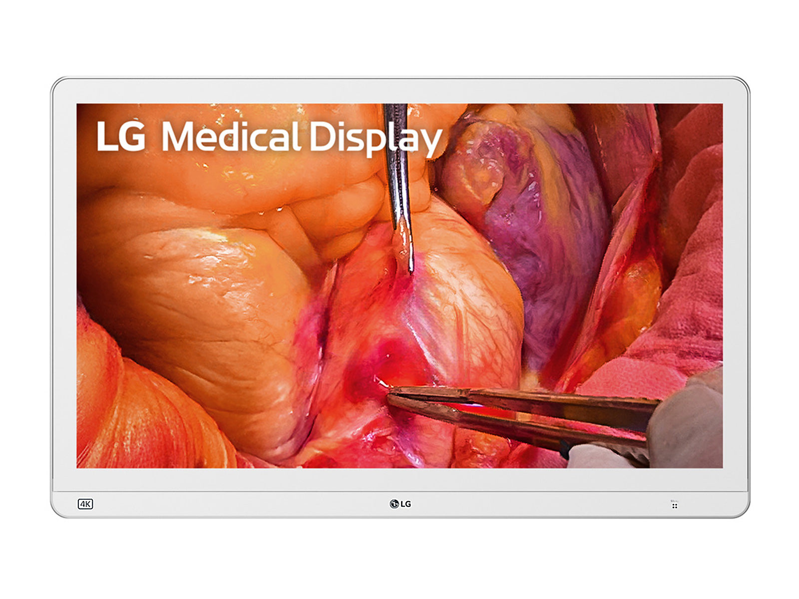 Monitor Médico LG 27HS714S-W 27" – Uso Quirúrgico (1)