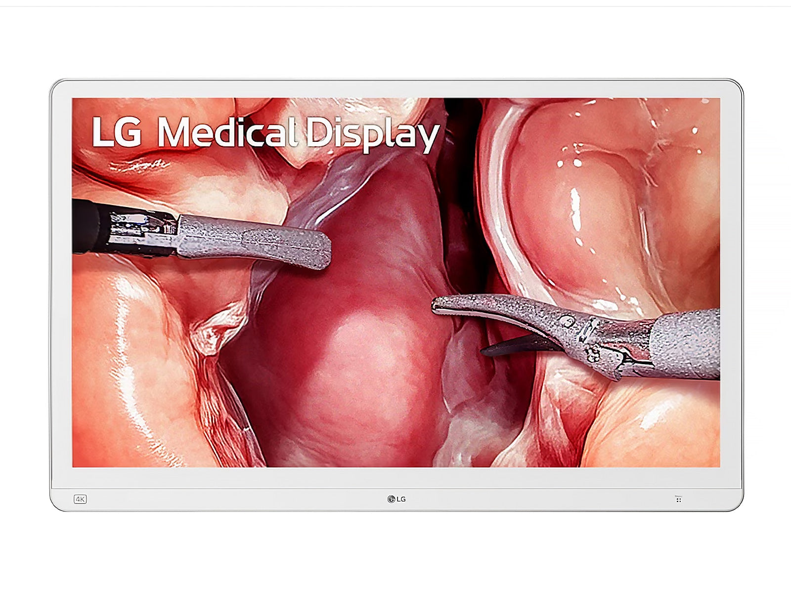 Monitor Médico LG 32HS710S-W 31.5" – Uso Quirúrgico (1)