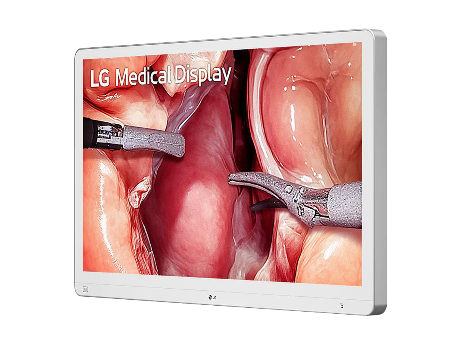 Monitor Médico LG 32HS710S-W 31.5" – Uso Quirúrgico (3)