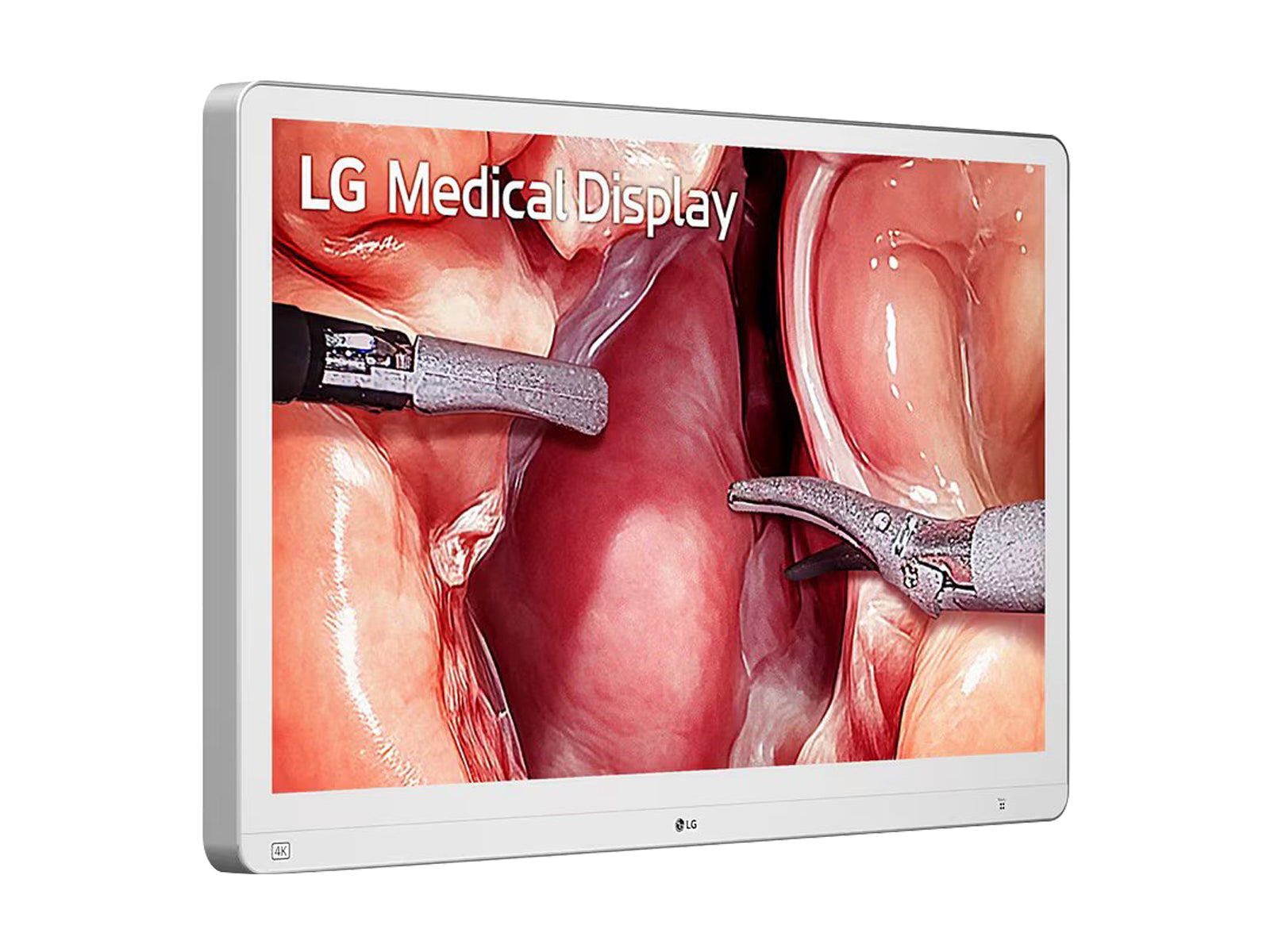 Monitor Médico LG 32HS710S-W 31.5" – Uso Quirúrgico (2)