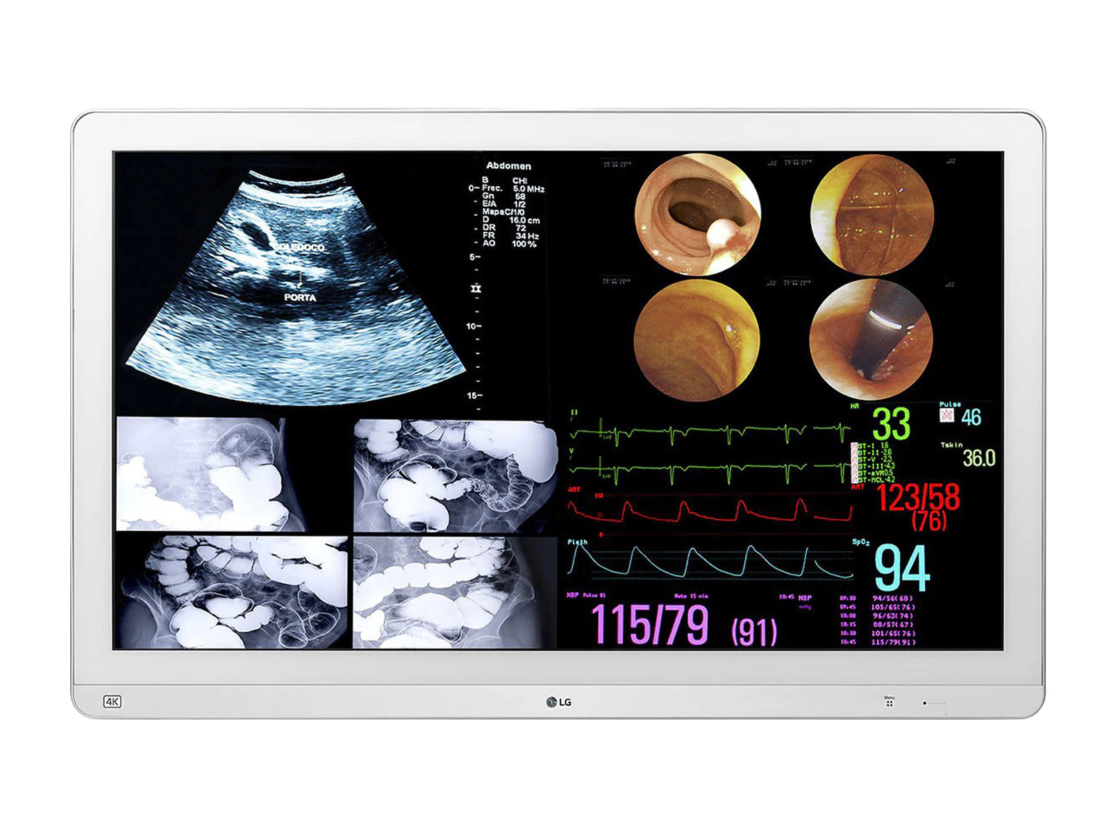 Monitor Médico LG 32HL714S-W 31.5" – Uso Quirúrgico DICOM (1)