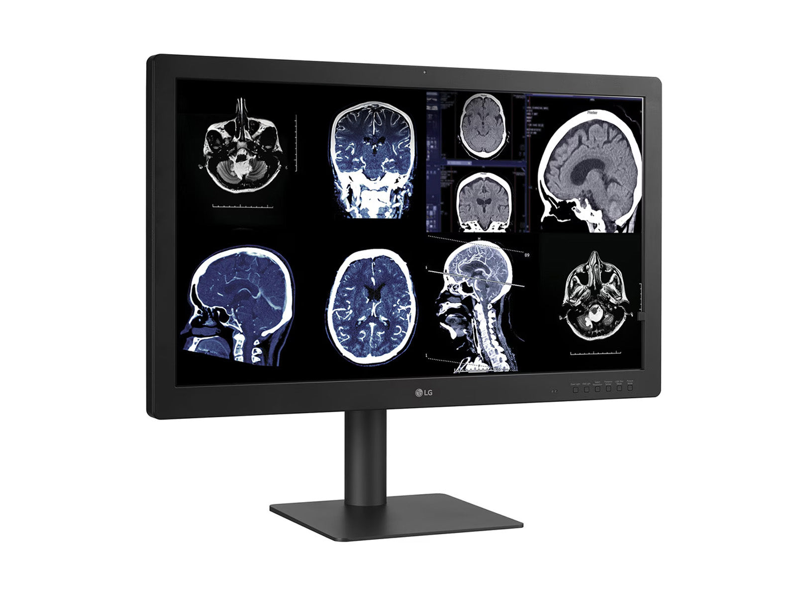 Monitor Médico LG 32HQ713D-B 8MP – 32" – Color – Radiología Diagnóstica DICOM (8)