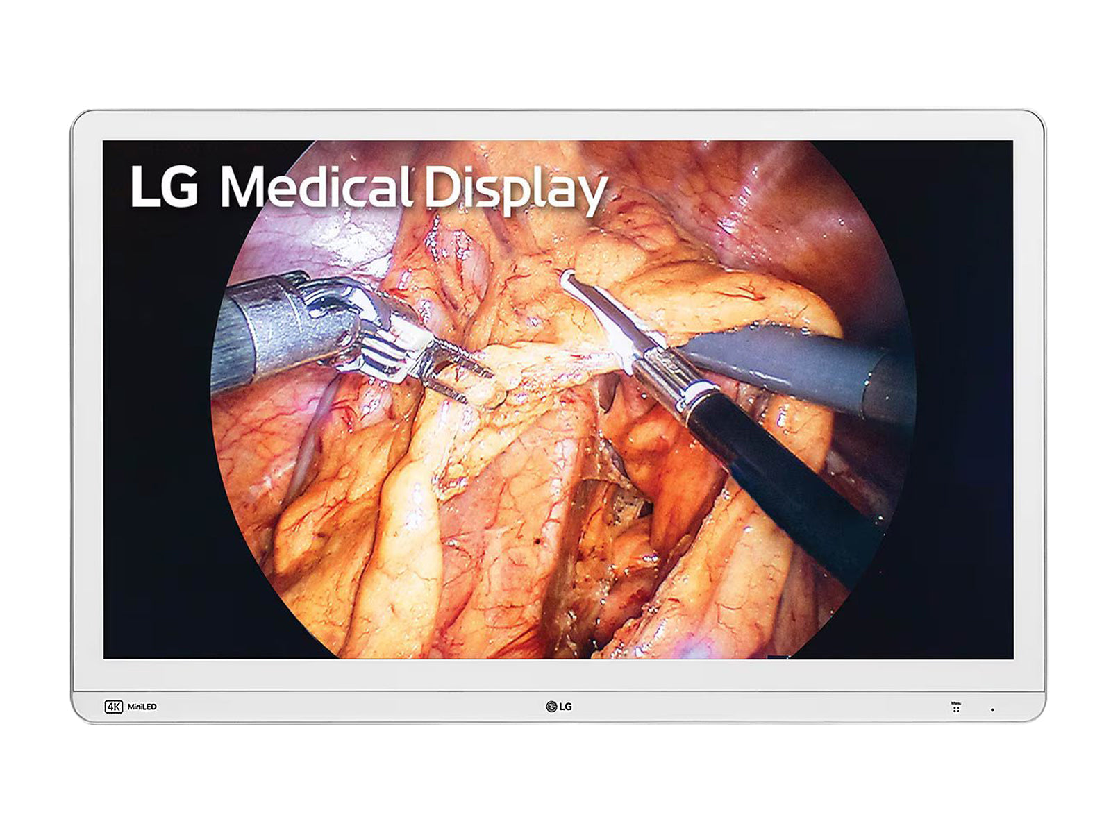 Monitor Médico LG 32HR734S-W 8MP – 31.5" – Uso Quirúrgico (1)