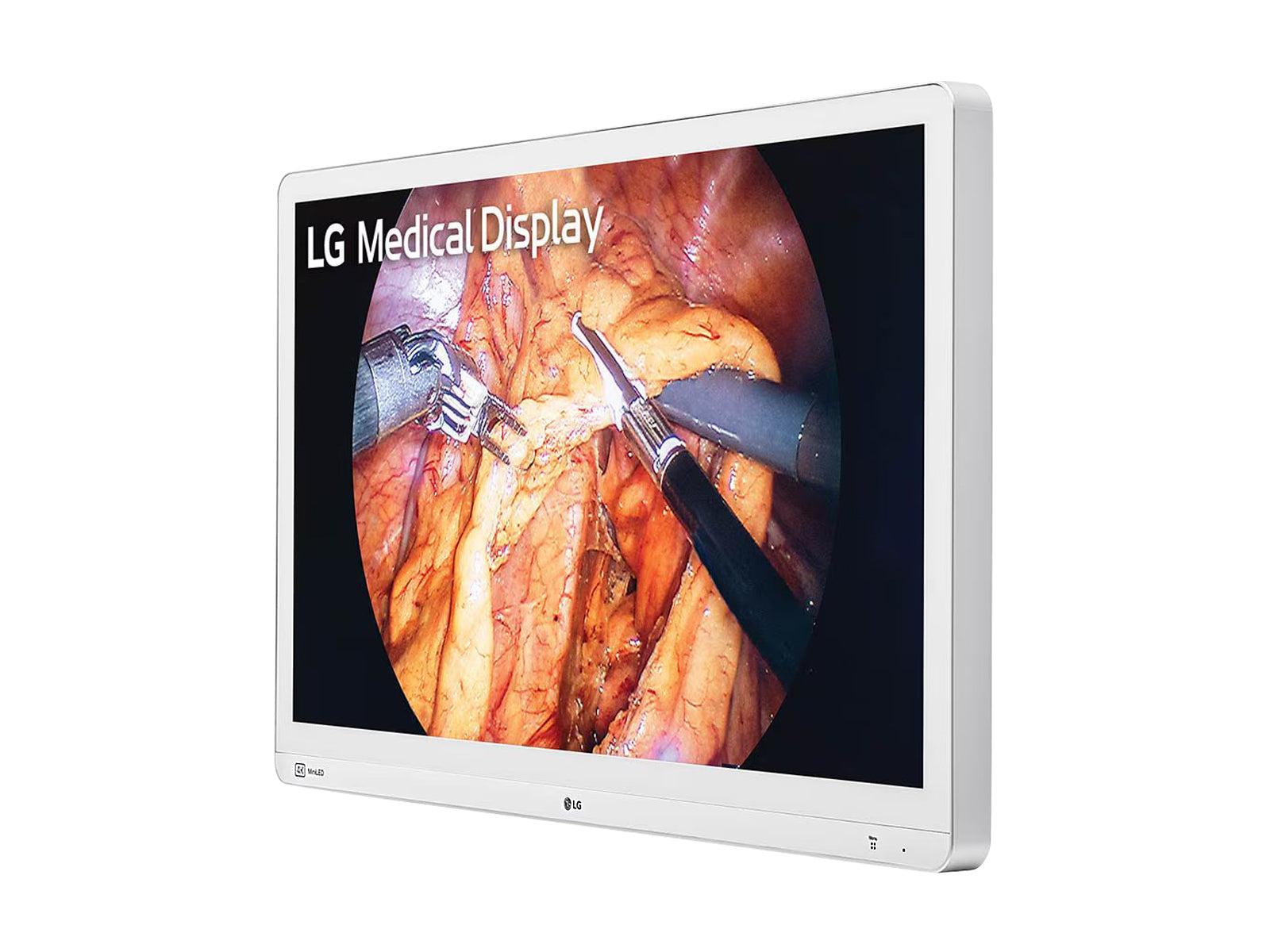 Monitor Médico LG 32HR734S-W 8MP – 31.5" – Uso Quirúrgico (3)