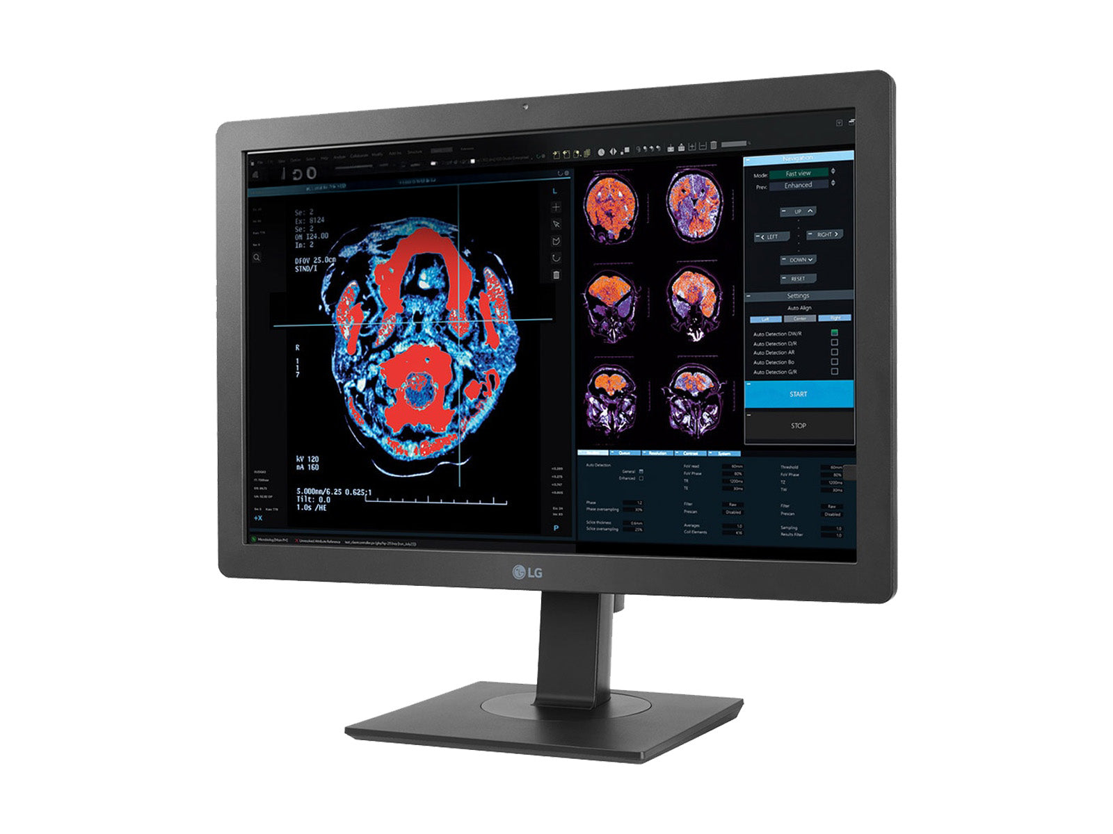 Monitor Médico LG 24HR513C-B 2MP – 24" – Radiología Diagnóstica DICOM (6)