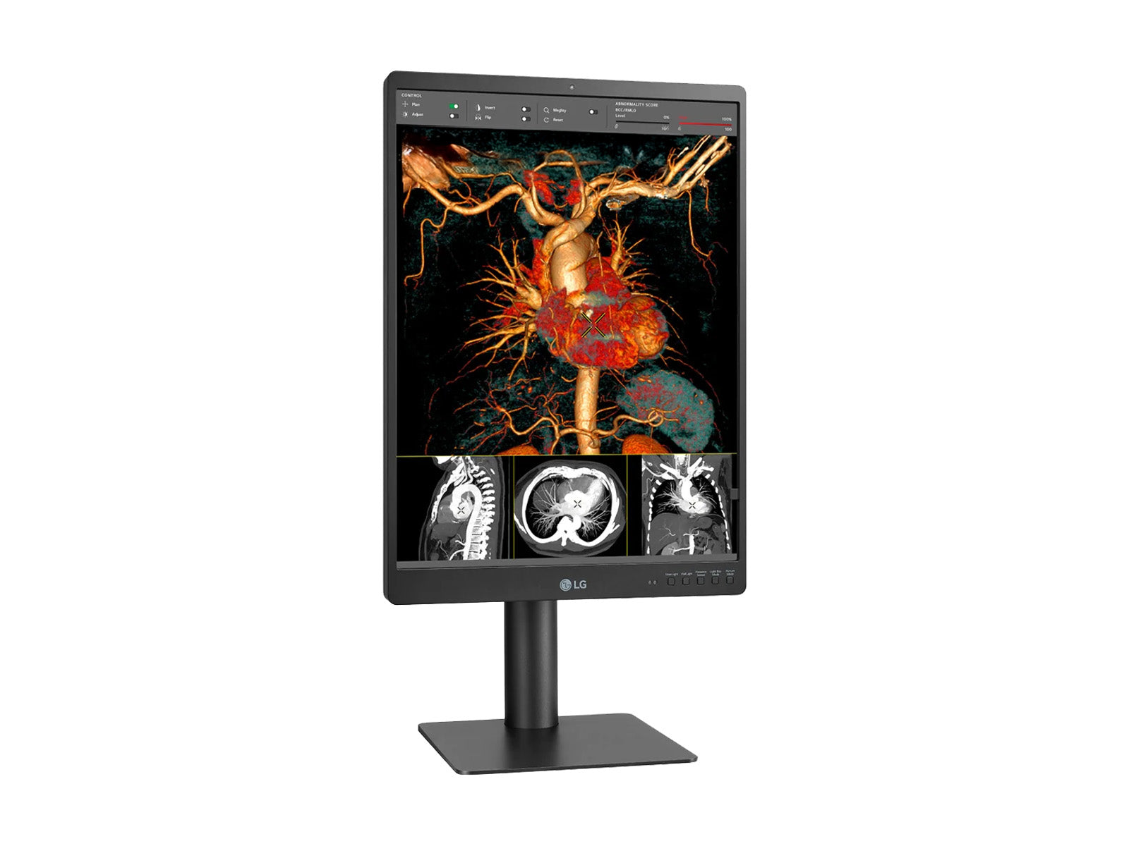 Monitor Médico LG 21HQ513D 3MP – 21" – Color – Radiología Diagnóstica (7)