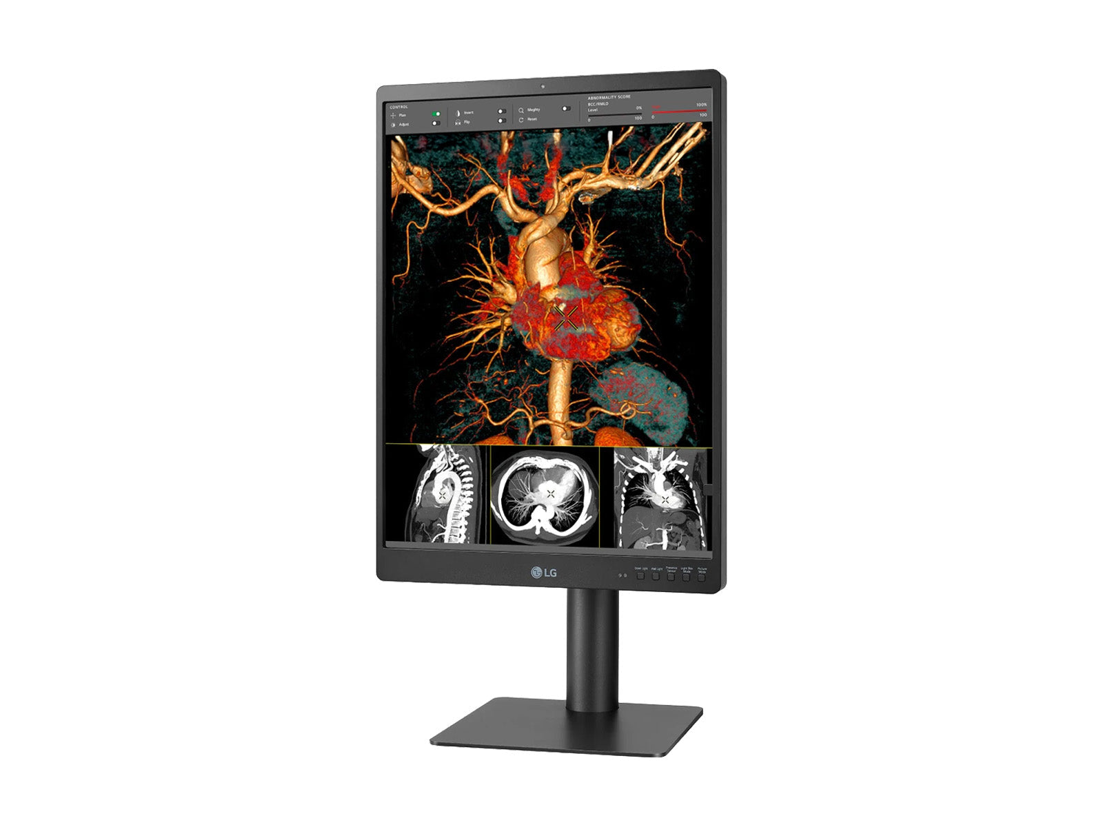 Monitor Médico LG 21HQ513D 3MP – 21" – Color – Radiología Diagnóstica (8)