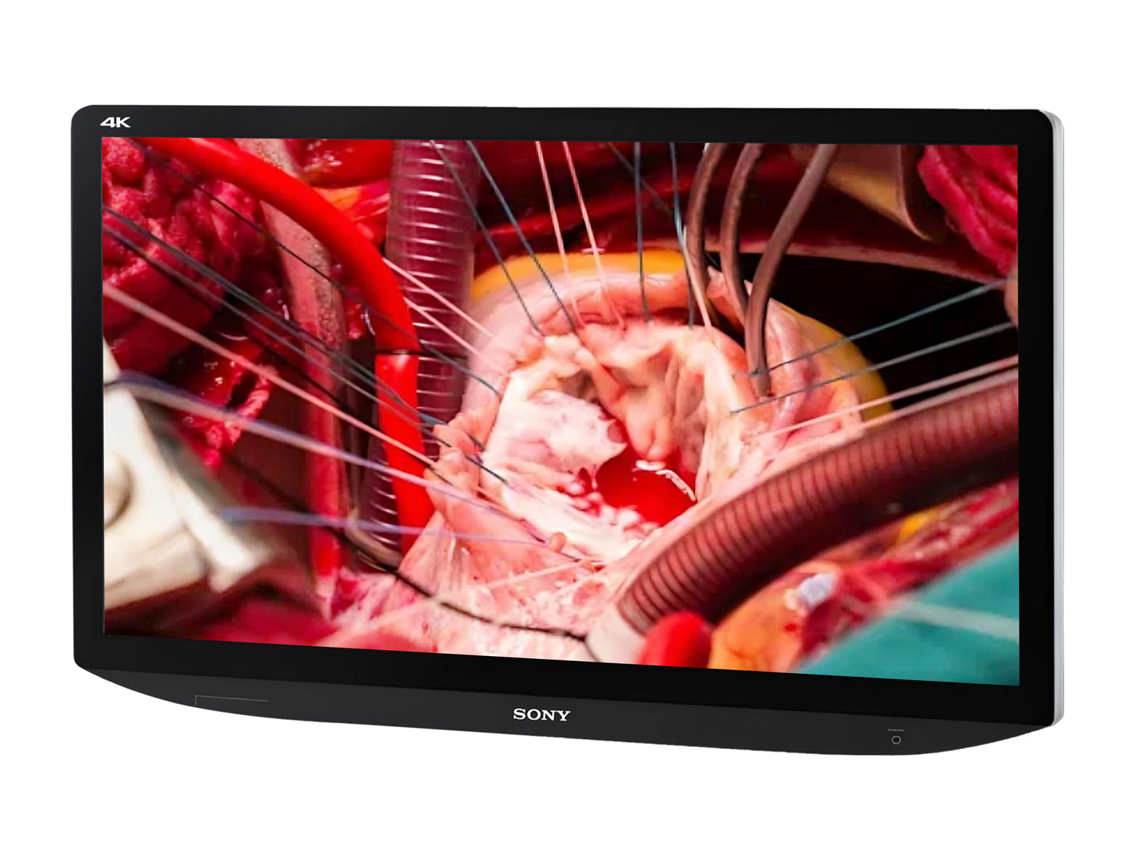 Monitor Médico Sony LMD-X310MT 31" – Uso Quirúrgico (2)