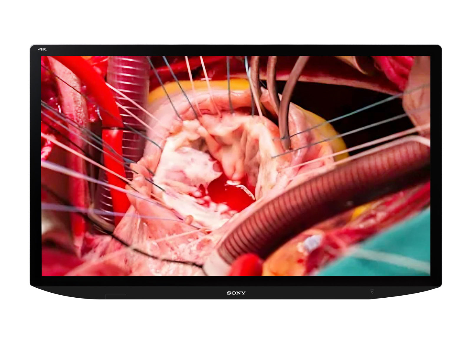 Monitor Médico Sony LMD-X310MT 31" – Uso Quirúrgico (1)