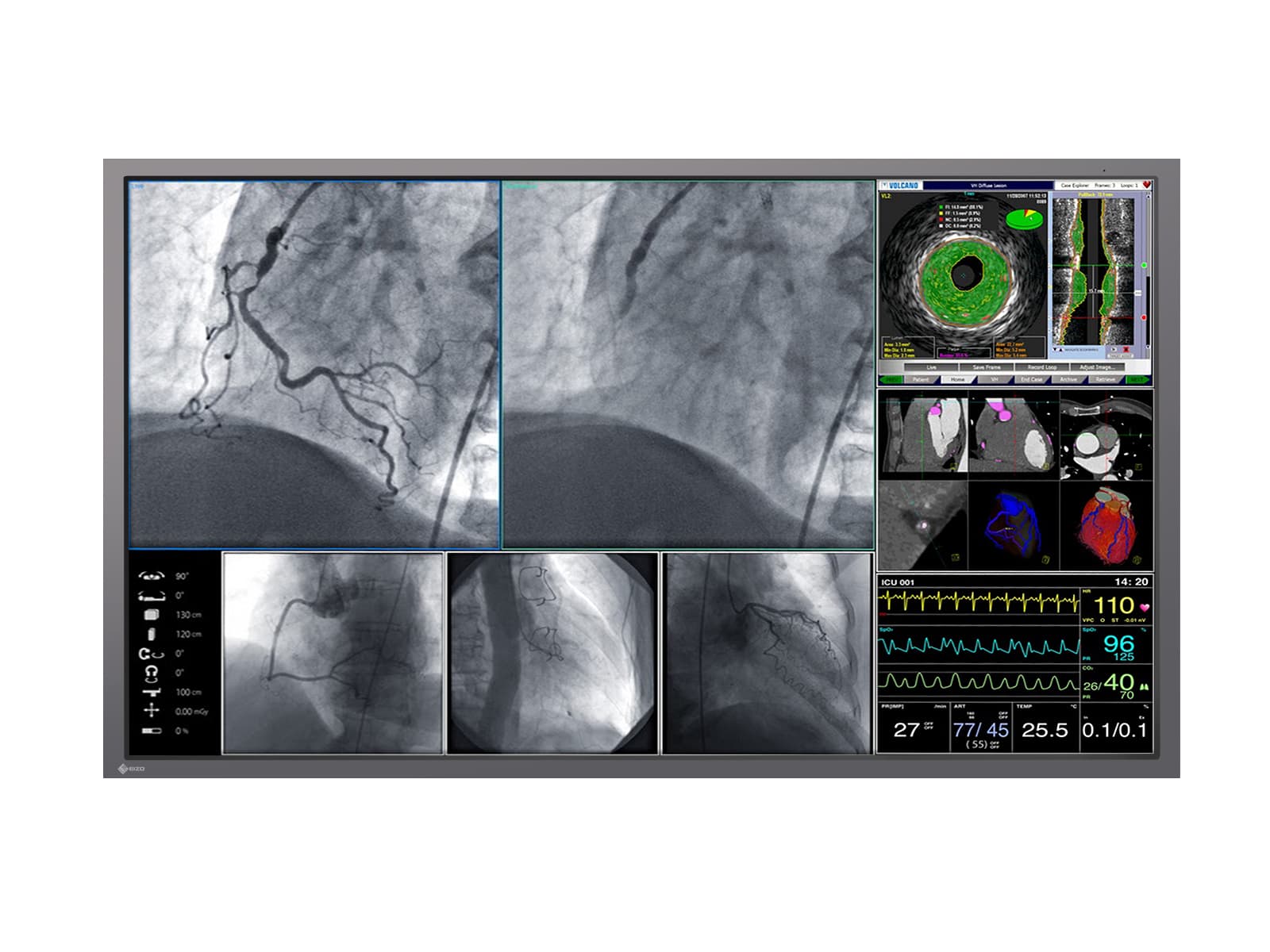 Monitor Médico Eizo LX600W 8MP – 60.1" – Uso Quirúrgico DICOM (1)
