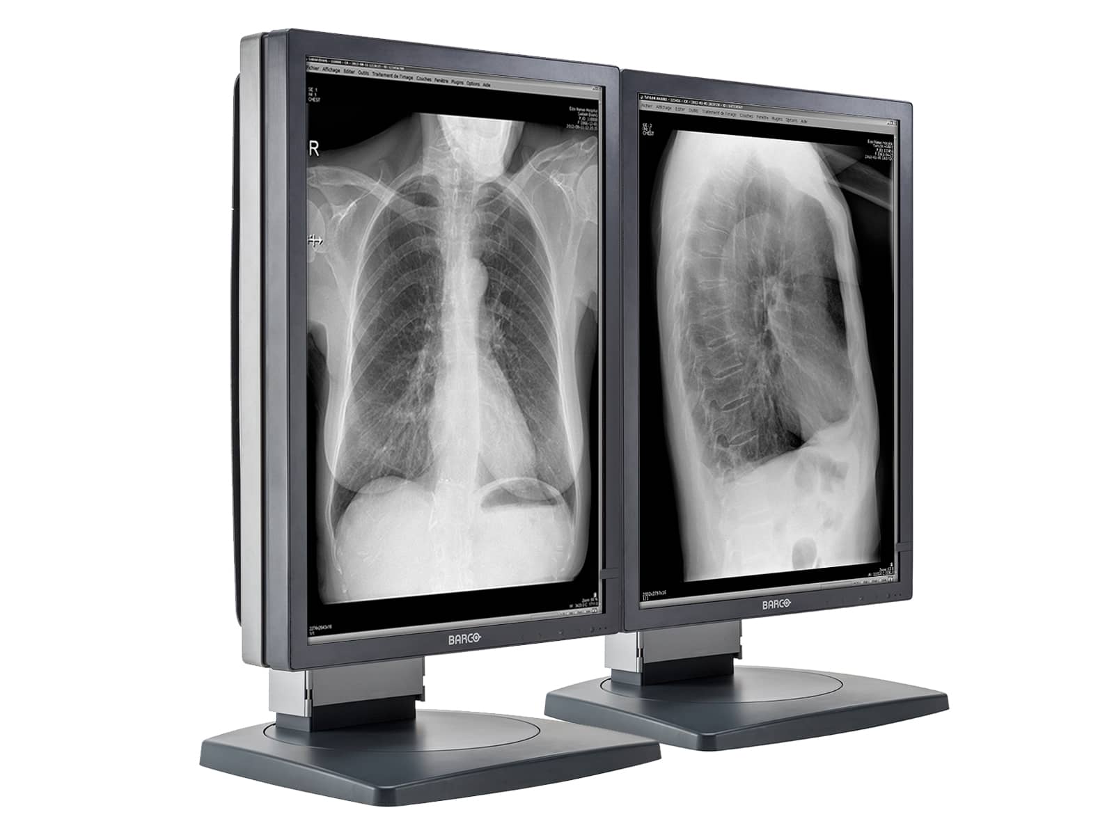 Monitor Médico Barco MDCG-3120 3MP – 20.8" – Escala de grises – Radiología Diagnóstica DICOM (2)