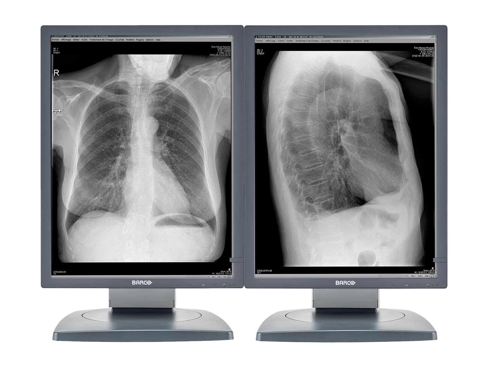 Monitor Médico Barco MDCG-3120 3MP – 20.8" – Escala de grises – Radiología Diagnóstica DICOM (1)