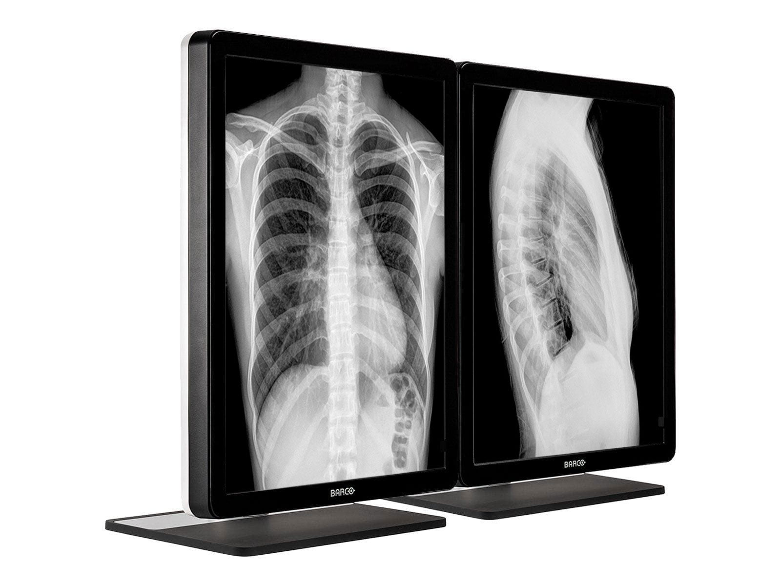 Monitor Médico Barco MDCG-3221 3MP – 21.3" – Escala de grises – Radiología Diagnóstica DICOM (2)