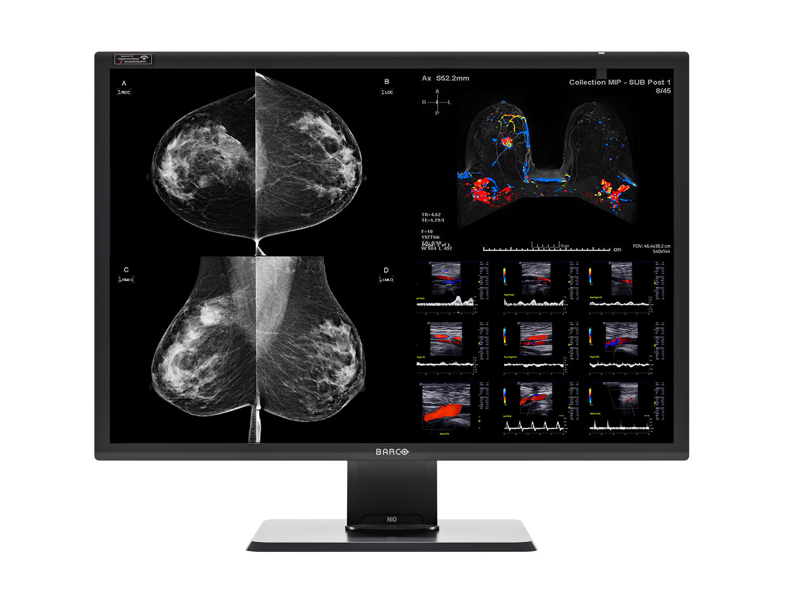 Monitor Médico Barco MDNC-12130 12MP – 30.9" – Color – Radiología Diagnóstica DICOM (1)