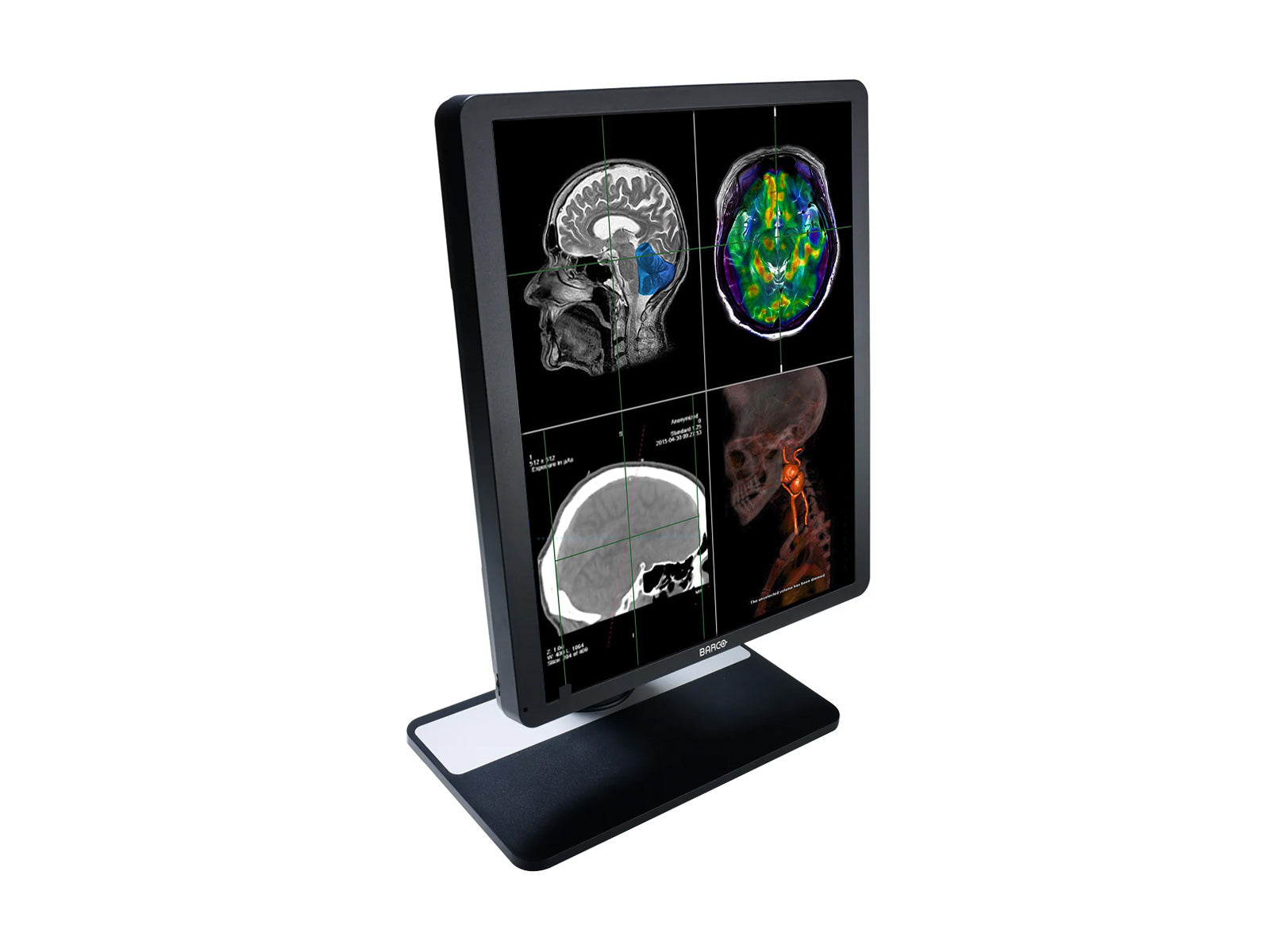 Monitor Médico Barco MDRC-1419 1MP – 19" – Revisión Clínica DICOM (2)