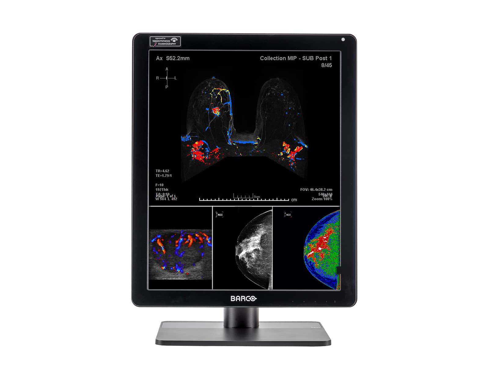 Monitor Médico Barco MDNC-6121 5MP – 21.3" – Color – Radiología Diagnóstica DICOM (3)