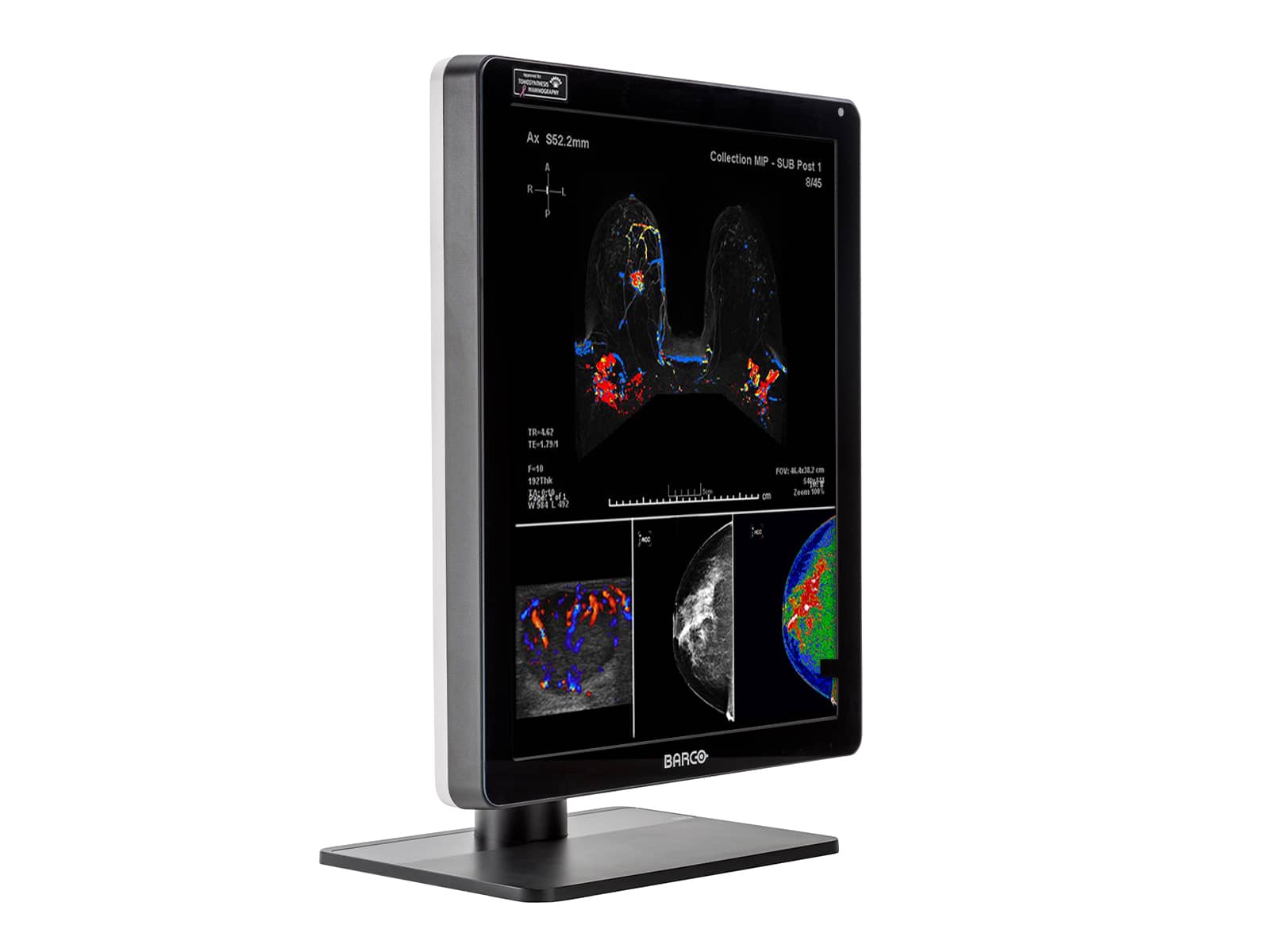Monitor Médico Barco MDNC-6121 5MP – 21.3" – Color – Radiología Diagnóstica DICOM (4)