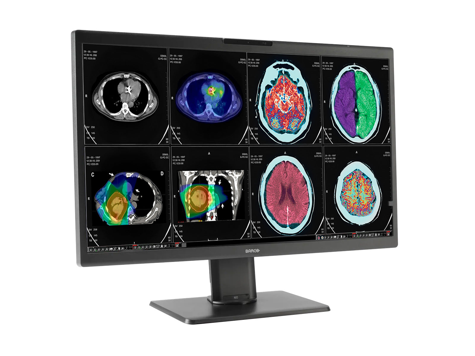 Monitor Médico Barco MDNC-8132 8MP – 32" – Color – Radiología Diagnóstica DICOM (2)
