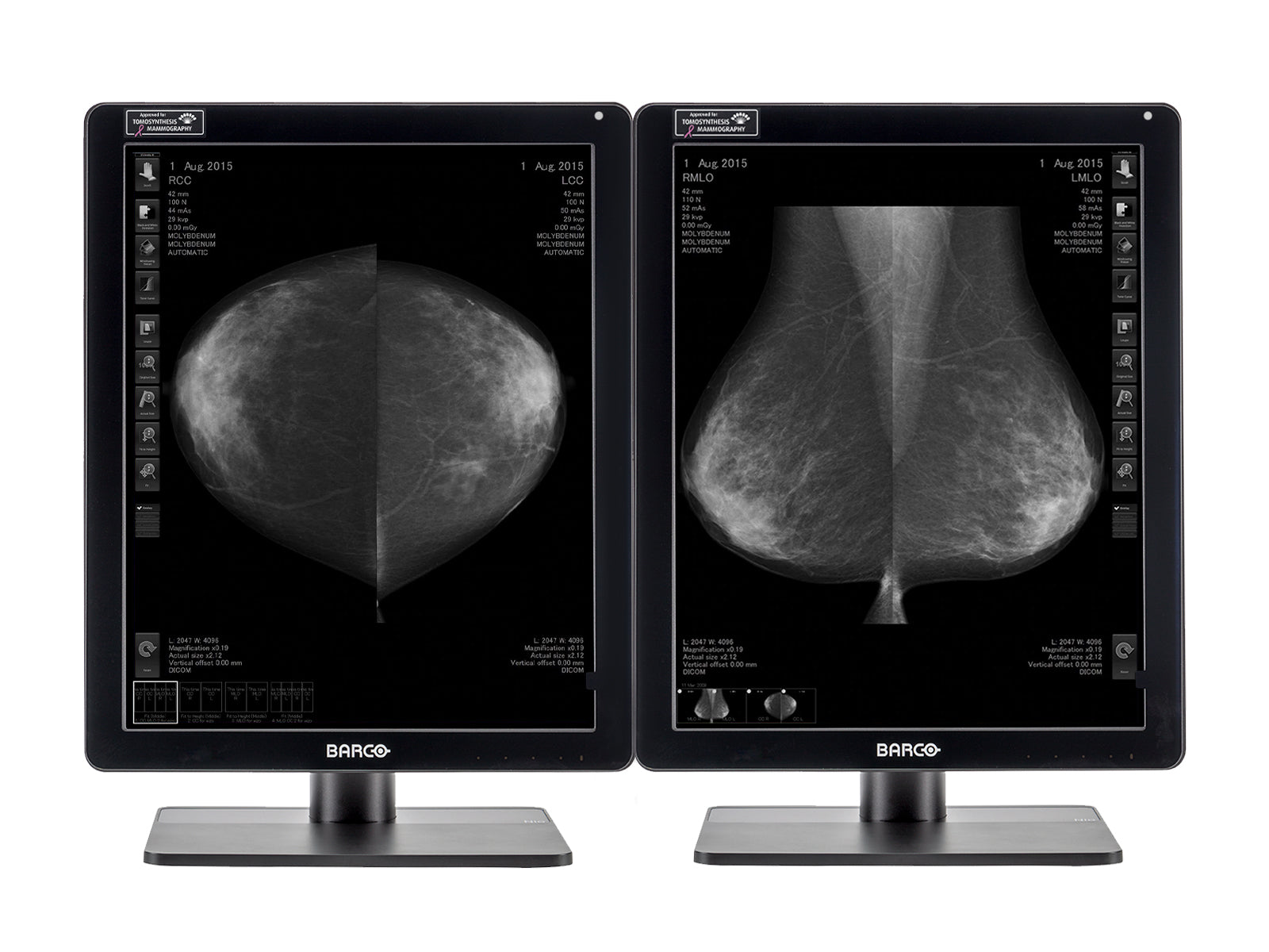 Monitor Médico Barco MDNG-6221 5MP – 21" – Escala de grises – Radiología Diagnóstica DICOM (1)