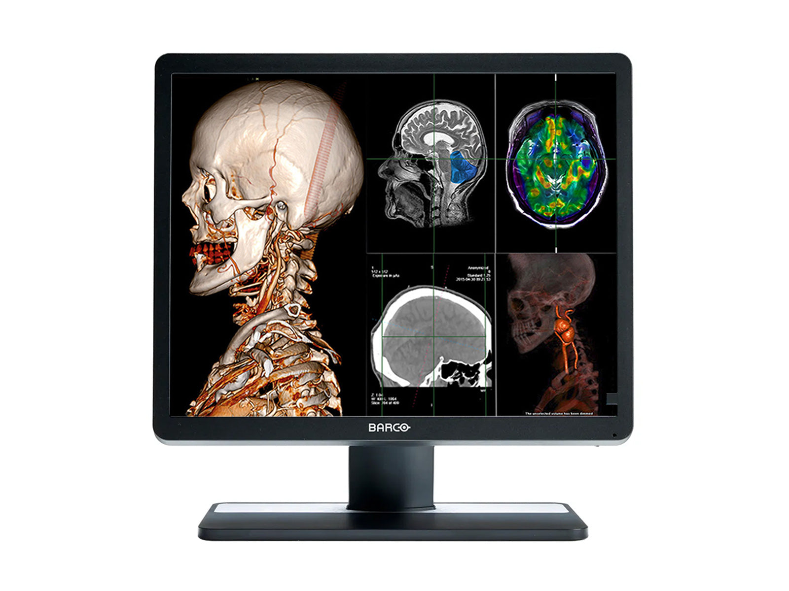 Monitor Médico Barco MDRC-1419 1MP – 19" – Revisión Clínica DICOM (1)