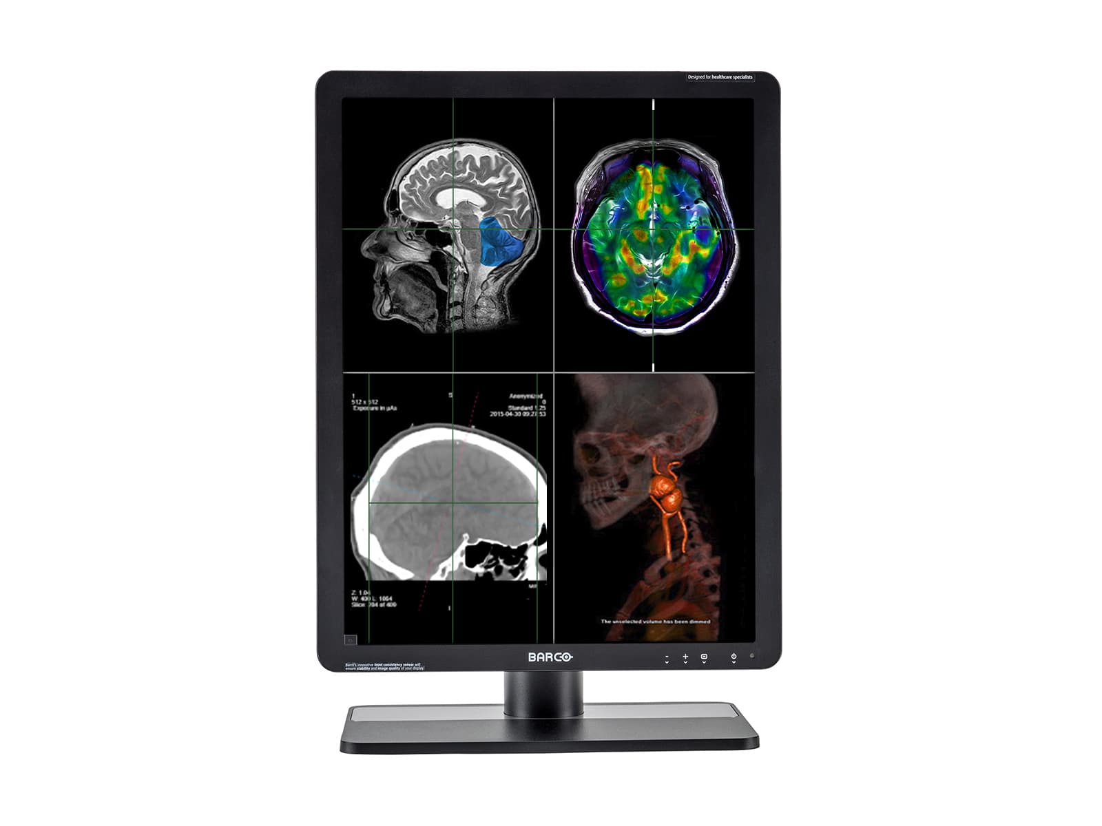 Monitor Médico Barco MDRC-2221 2MP – 21" – Radiología Diagnóstica DICOM (2)