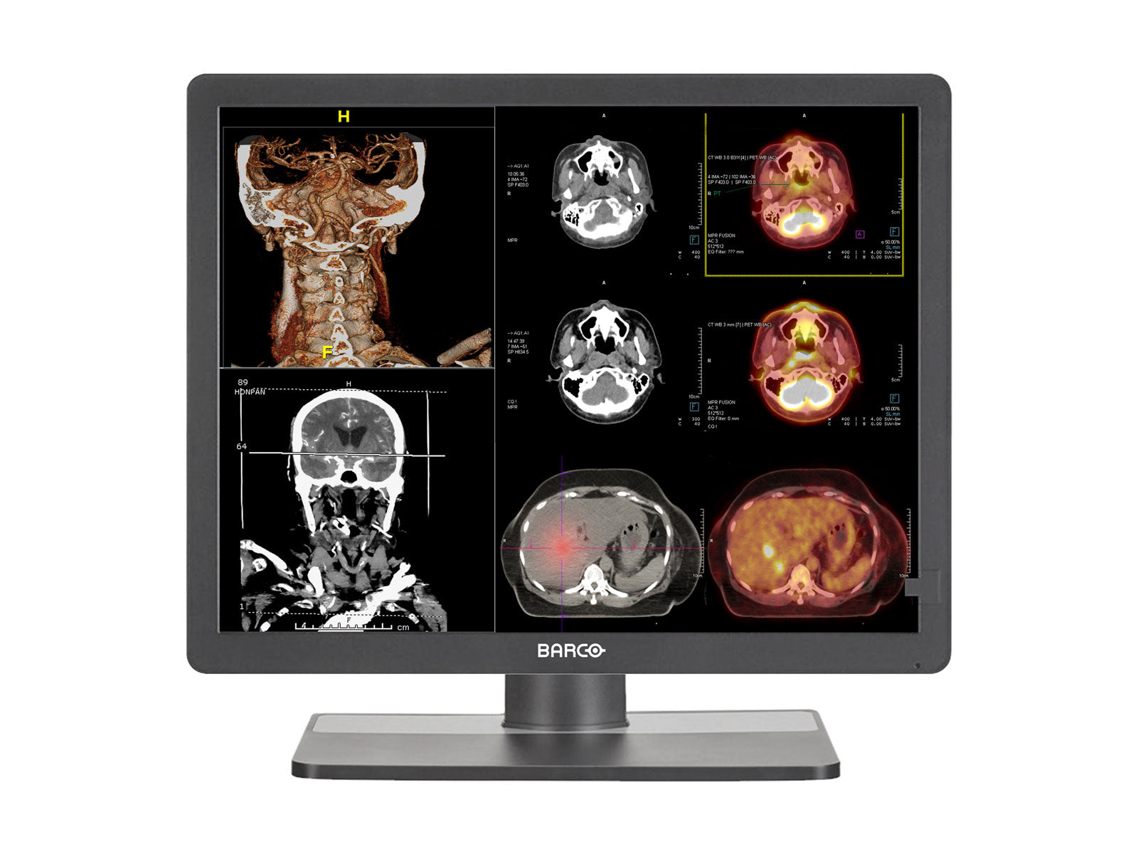 Monitor Médico Barco MDRC-2321 2MP – 21" – Color – Revisión Clínica (1)