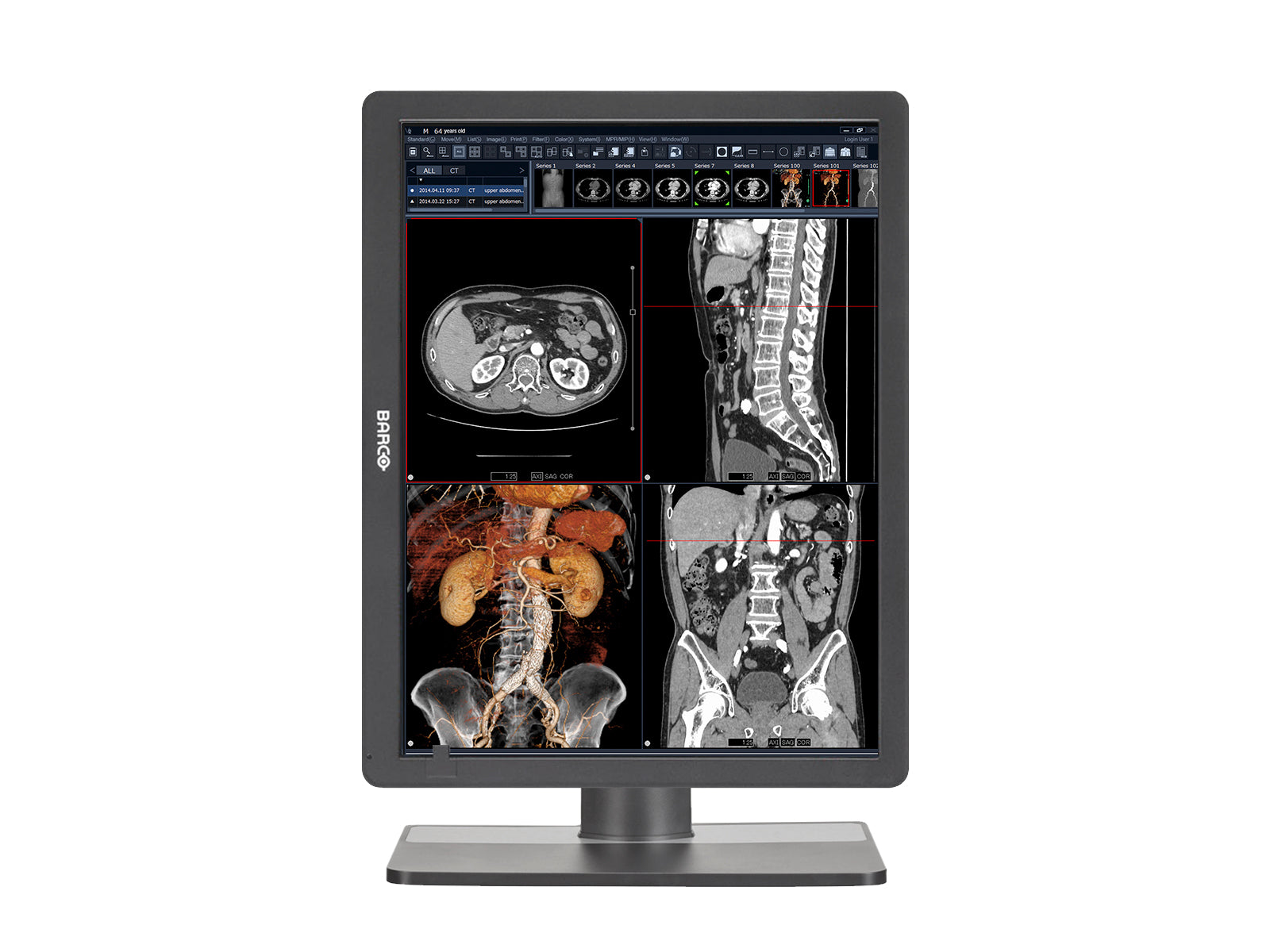 Monitor Médico Barco MDRC-2321 2MP – 21" – Color – Revisión Clínica (2)