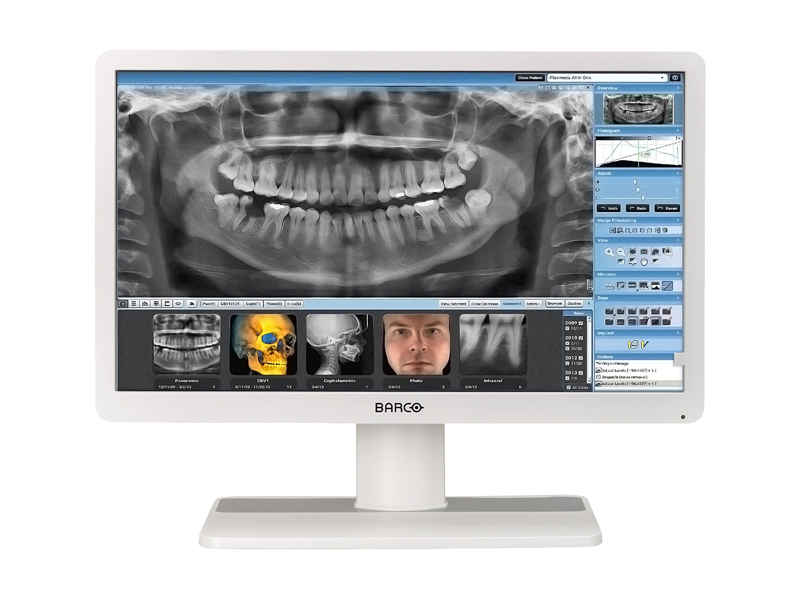 Monitor Médico Barco MDRC-2324 2MP – 24" – Revisión Clínica (1)